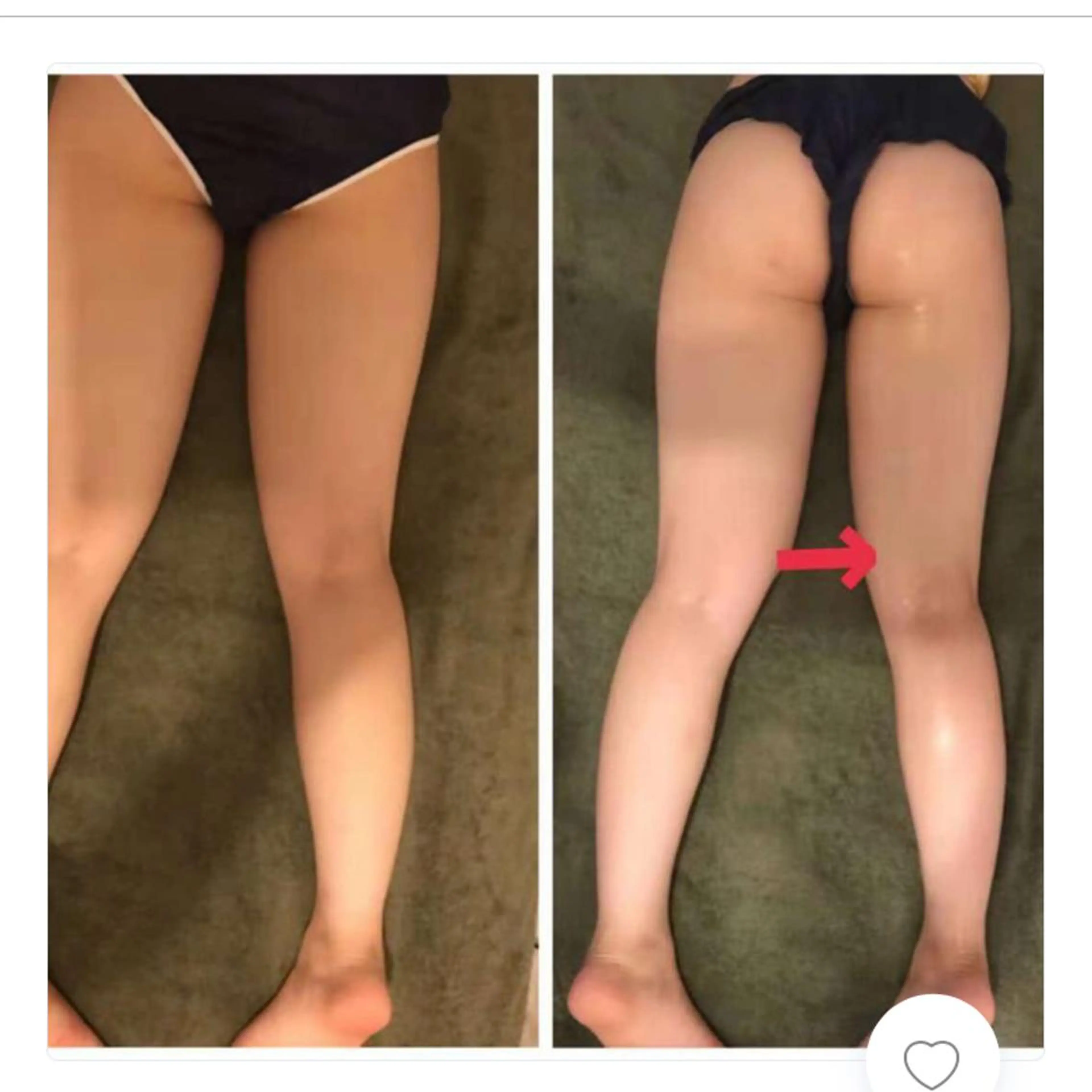 ショート リラク リラクゼーション＆エステランベリー所属・ランベリ ランベリのエステ・リラクイメージ