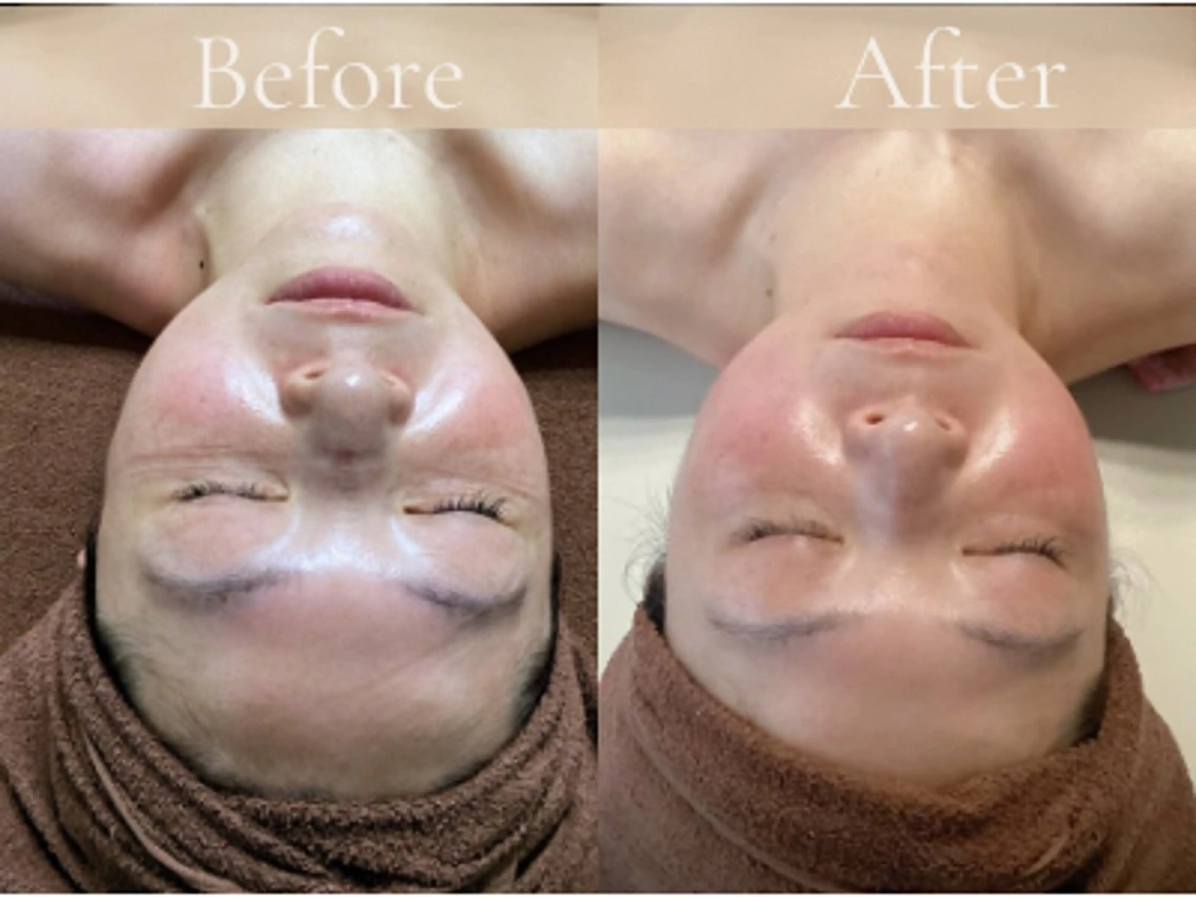 【小顔】韓国小顔コルギ+背中アロマ90分の写真