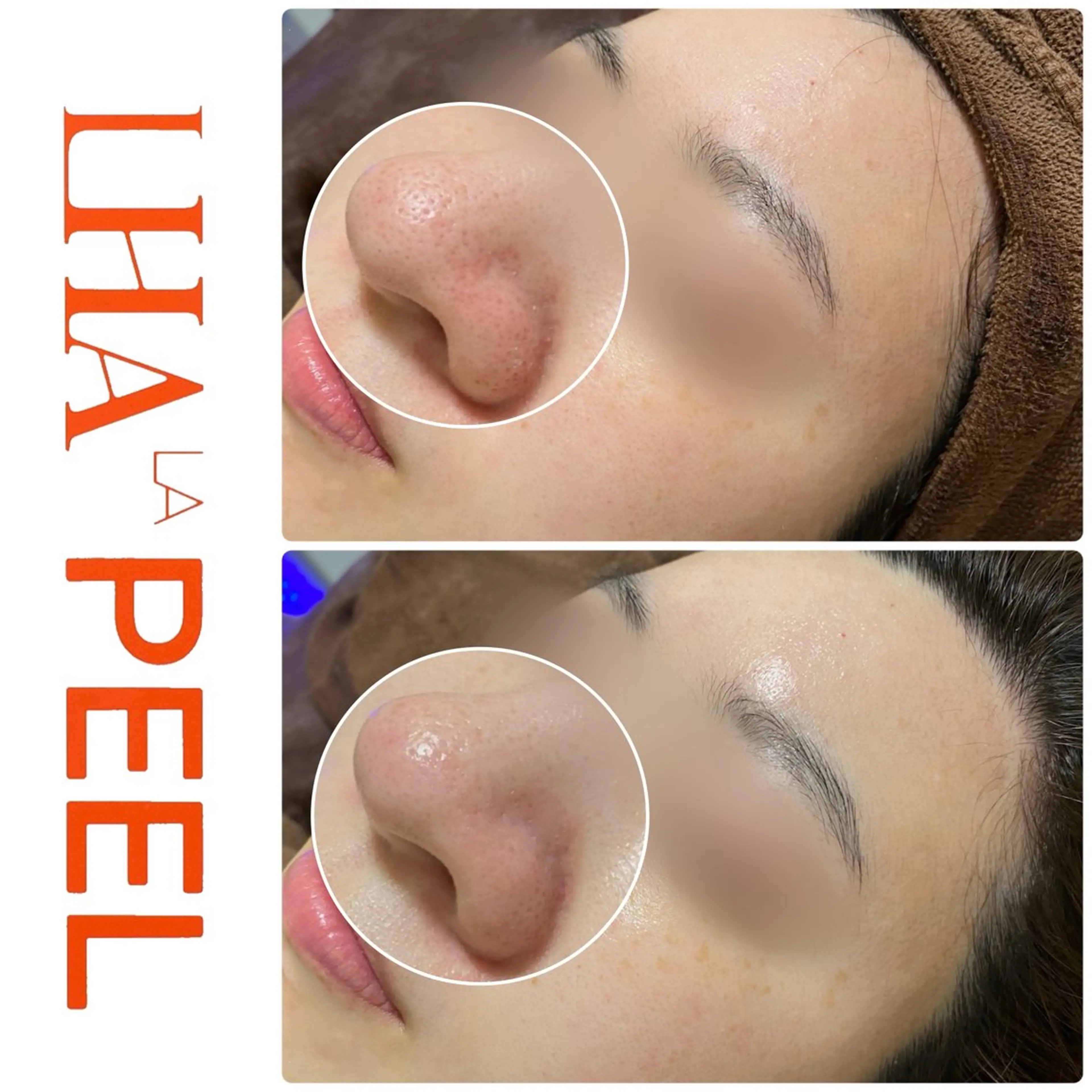 エステ ハーブピーリング専門 BIOEL横浜のエステ・リラクイメージ