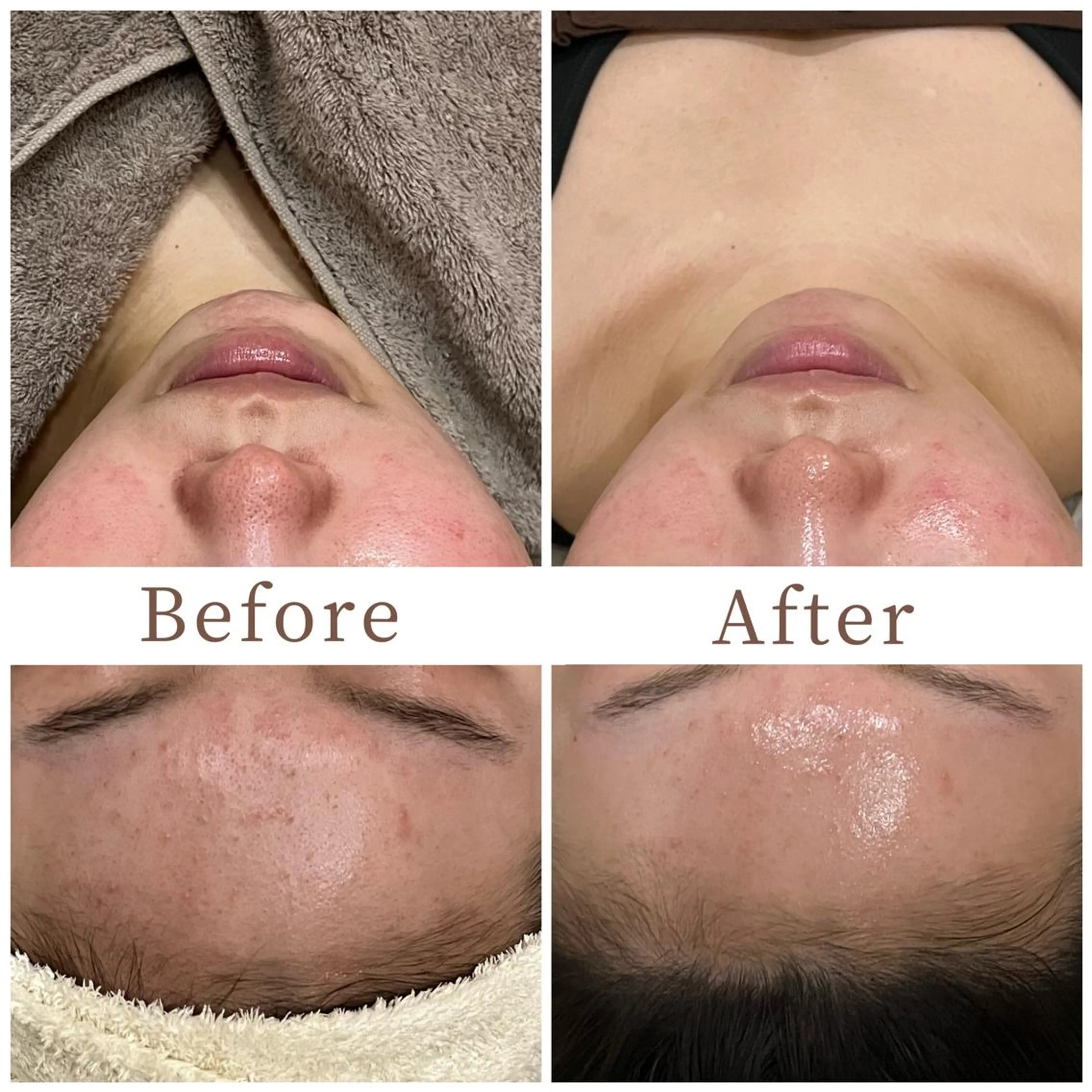 ハーブピーリング専門 muro.のエステ・リラクイメージ