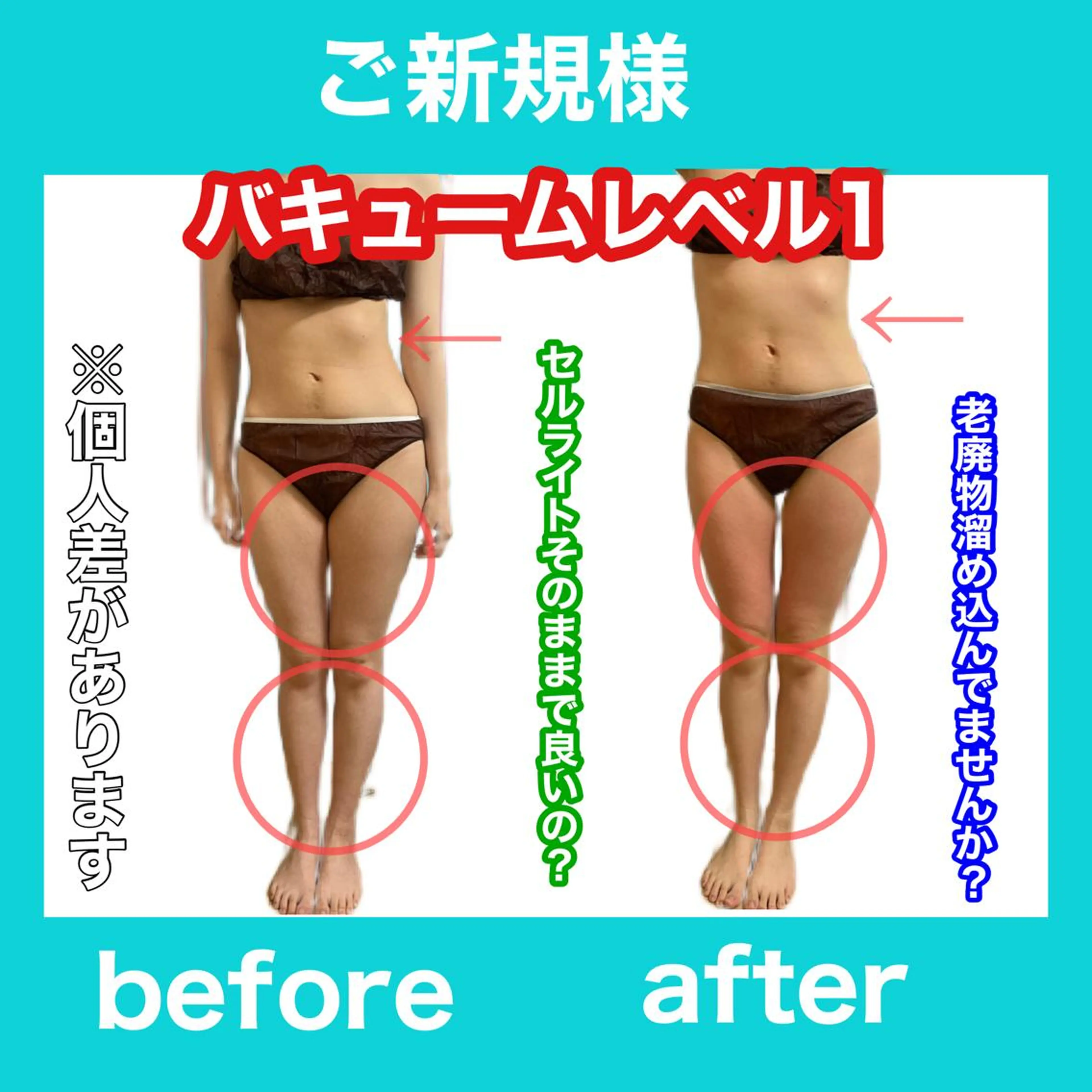 エステ リラク 痩身/脱毛/ネイル HARUKAのエステ・リラクイメージ