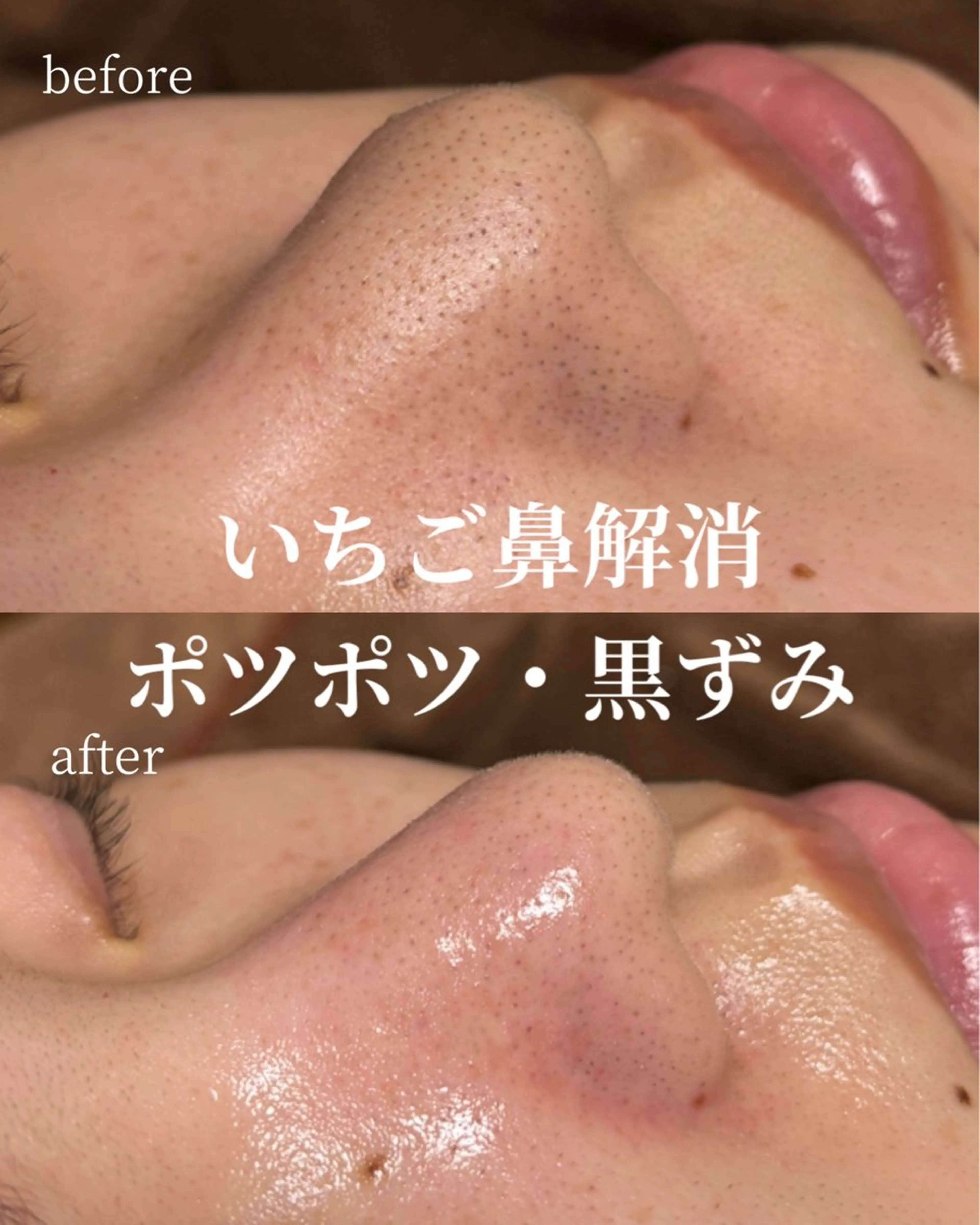 エステ HINANO矢場町店【ヒナノ】所属・脱毛/肌改善🌿 HINANO 村田のエステ・リラクイメージ