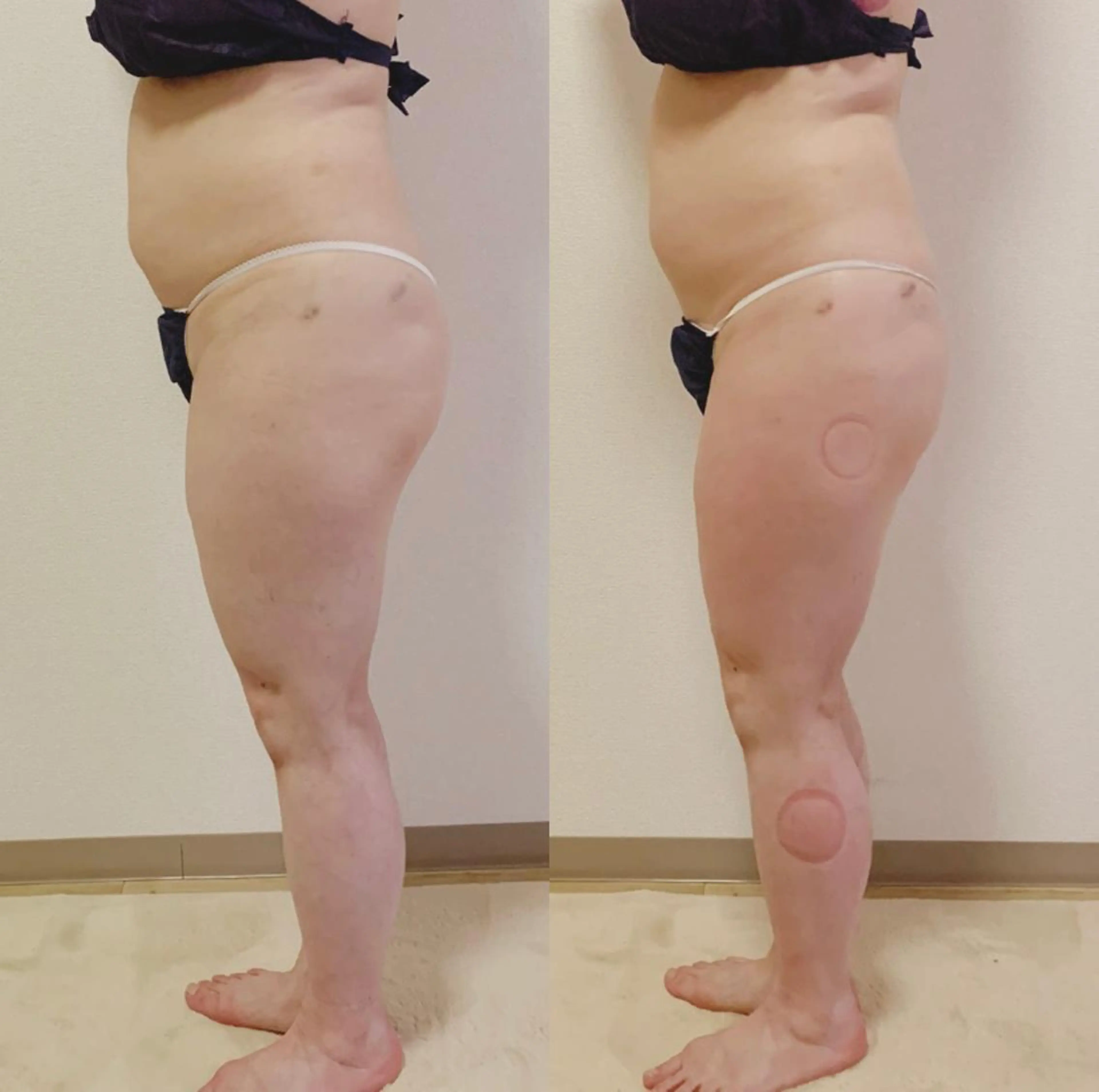 a  room salonのエステ・リラクイメージ