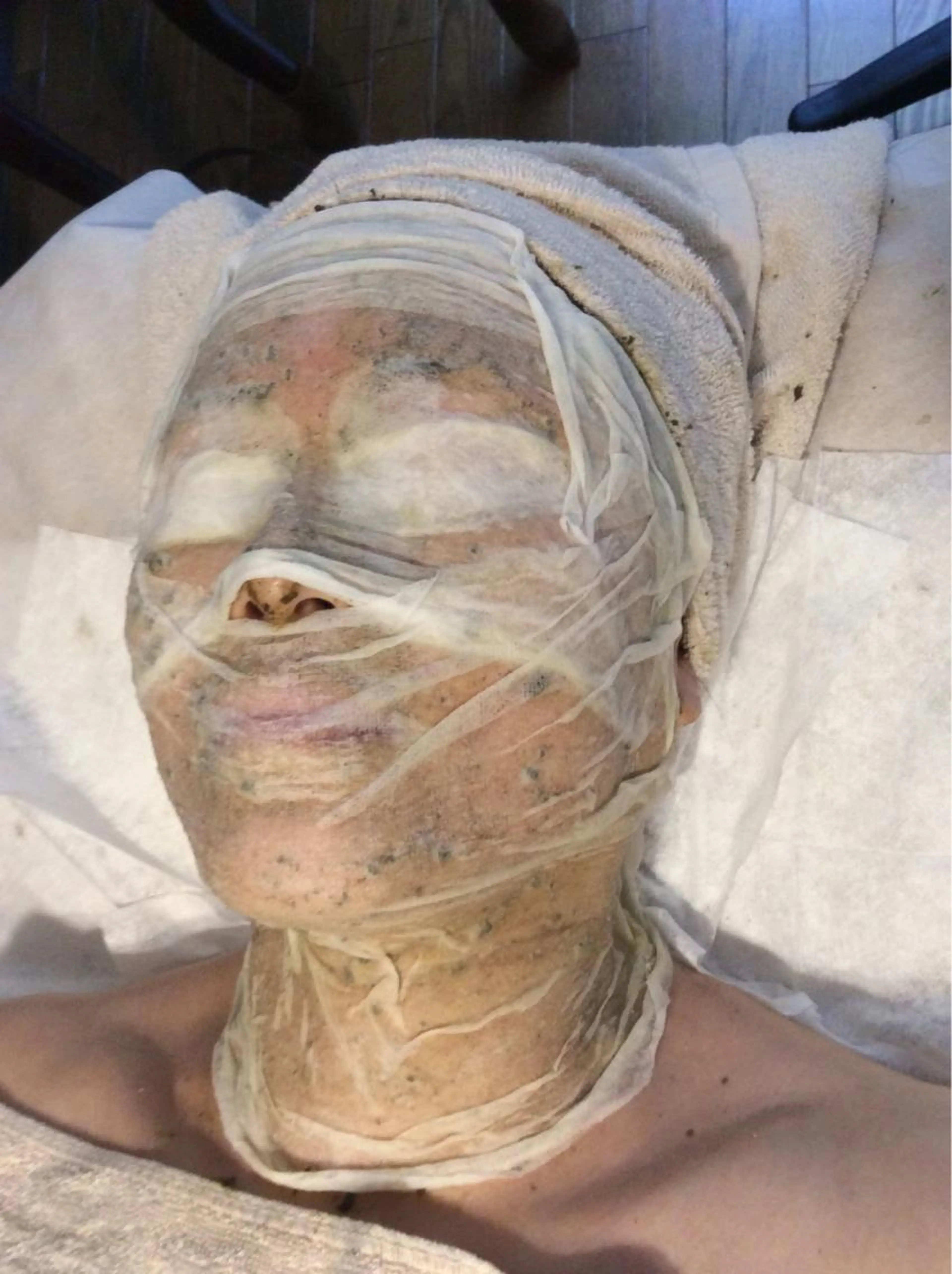 メンズスキンリノベーションコース【メンズ✴︎ミニモ 限定】ハーブピーリング剥離ありの写真