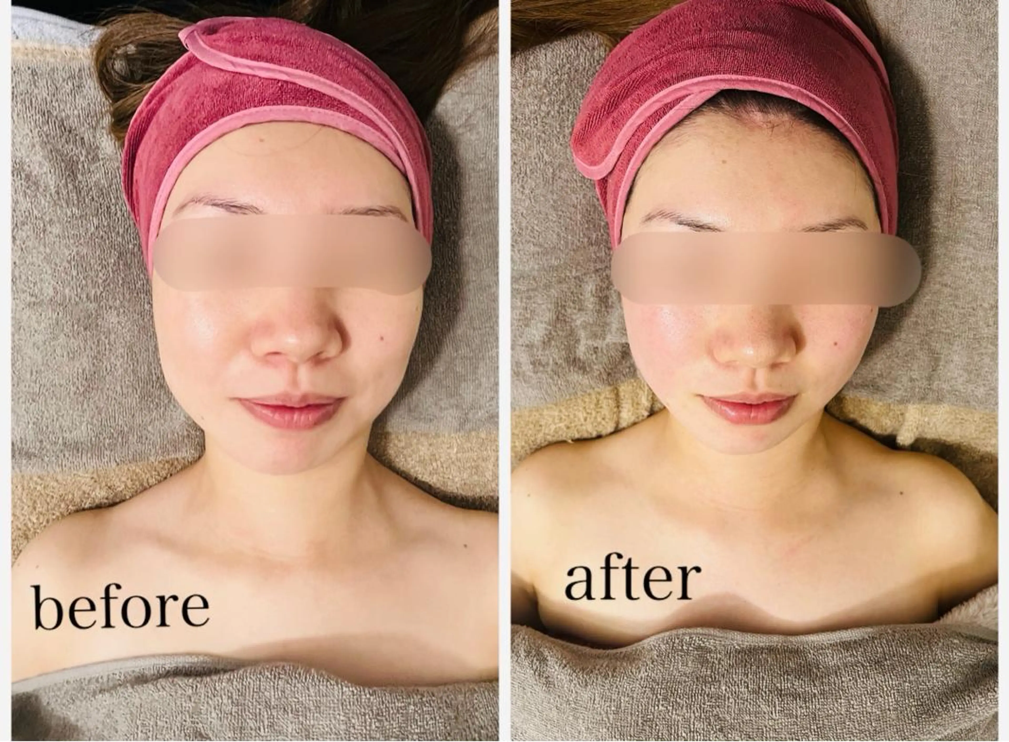 ボディ&フェイシャルサロン SHINE-シャイン-所属・ボディ&フェイシャル サロンSHINEのエステ・リラクイメージ