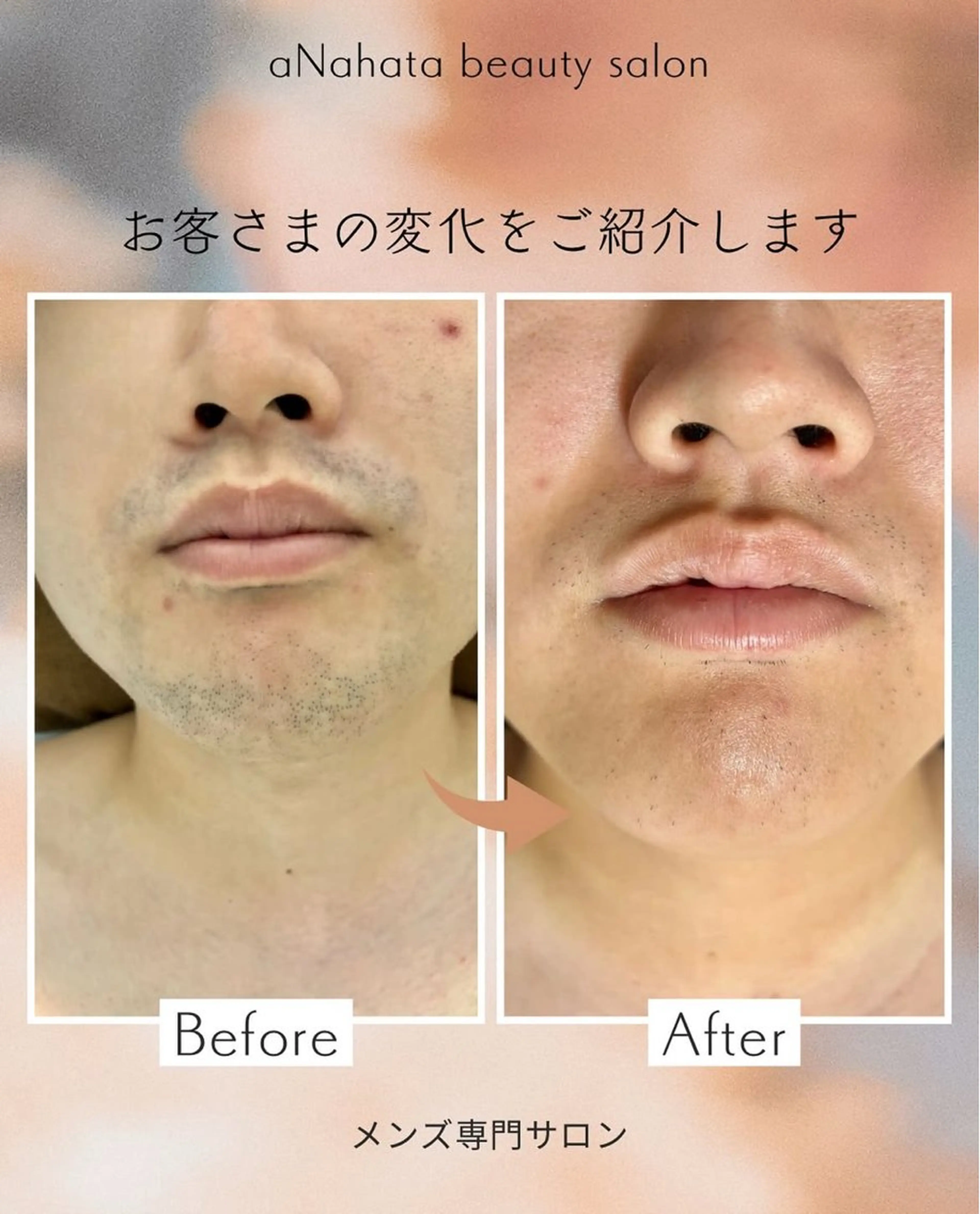 メンズ aNahata beauty salon所属・田中 菜月のエステ・リラクイメージ