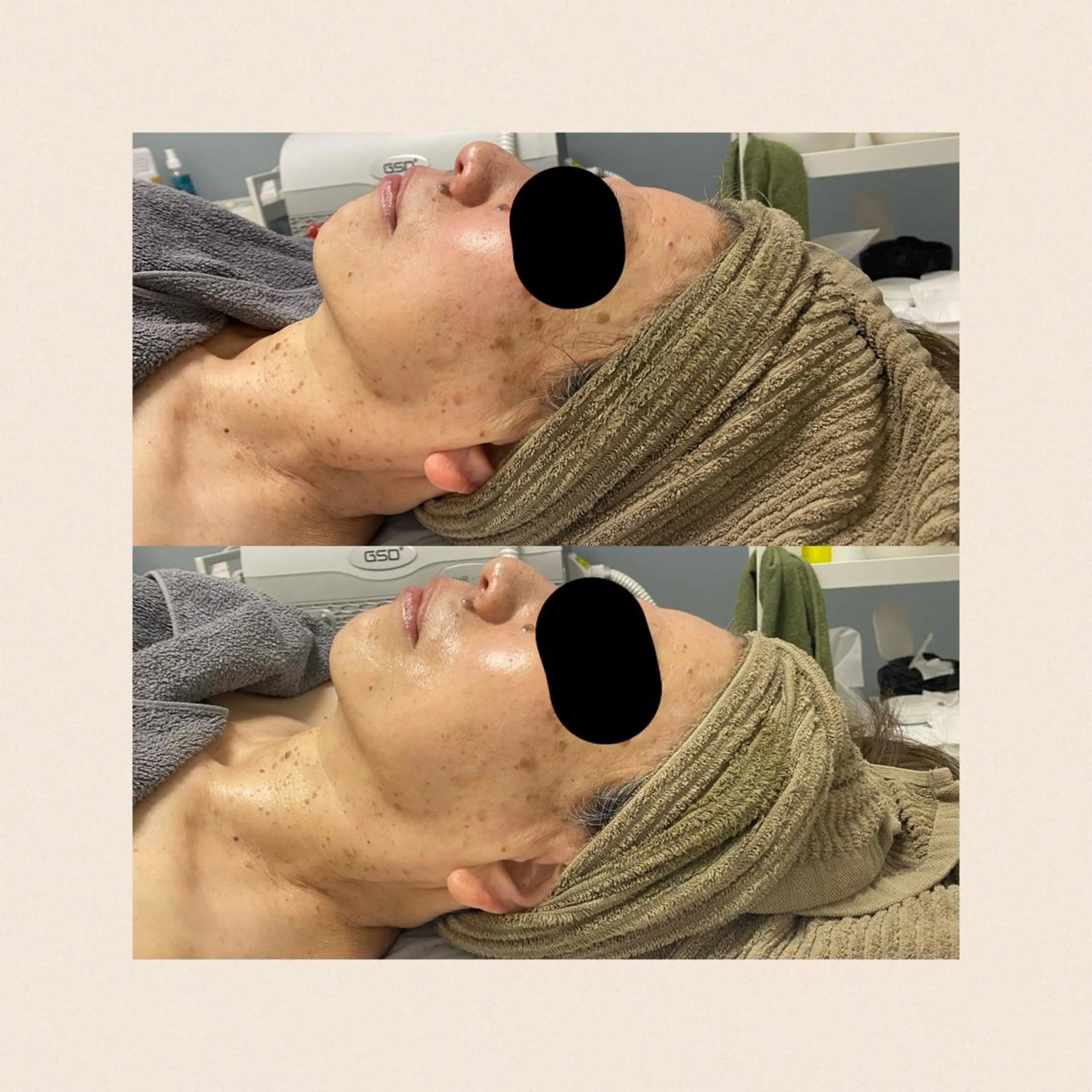 salon_ A所属・MAE ASUKAのエステ・リラクイメージ