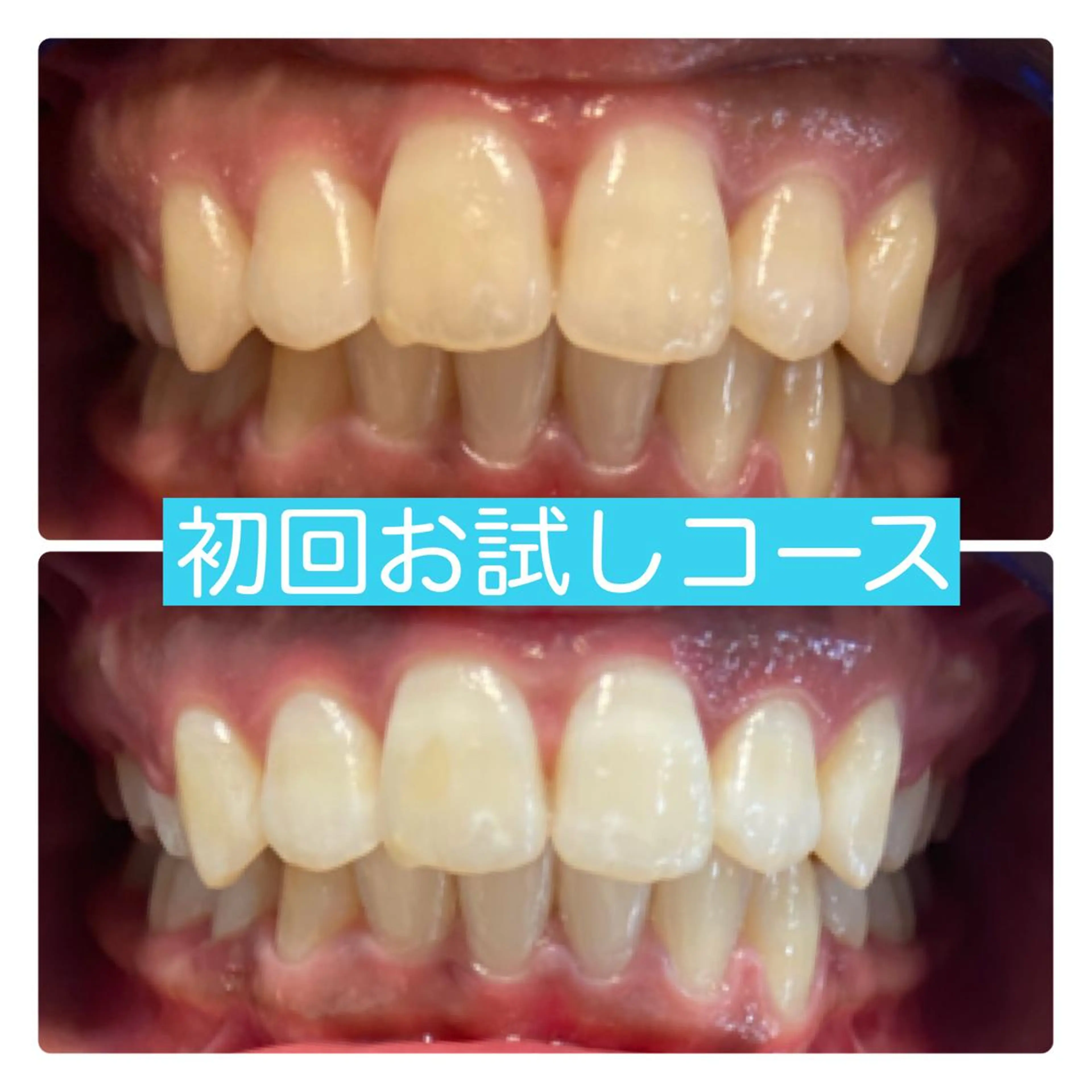 その他 PLATINUM Beauty 横浜店所属・ホワイトニングルーム 横浜店のその他イメージ