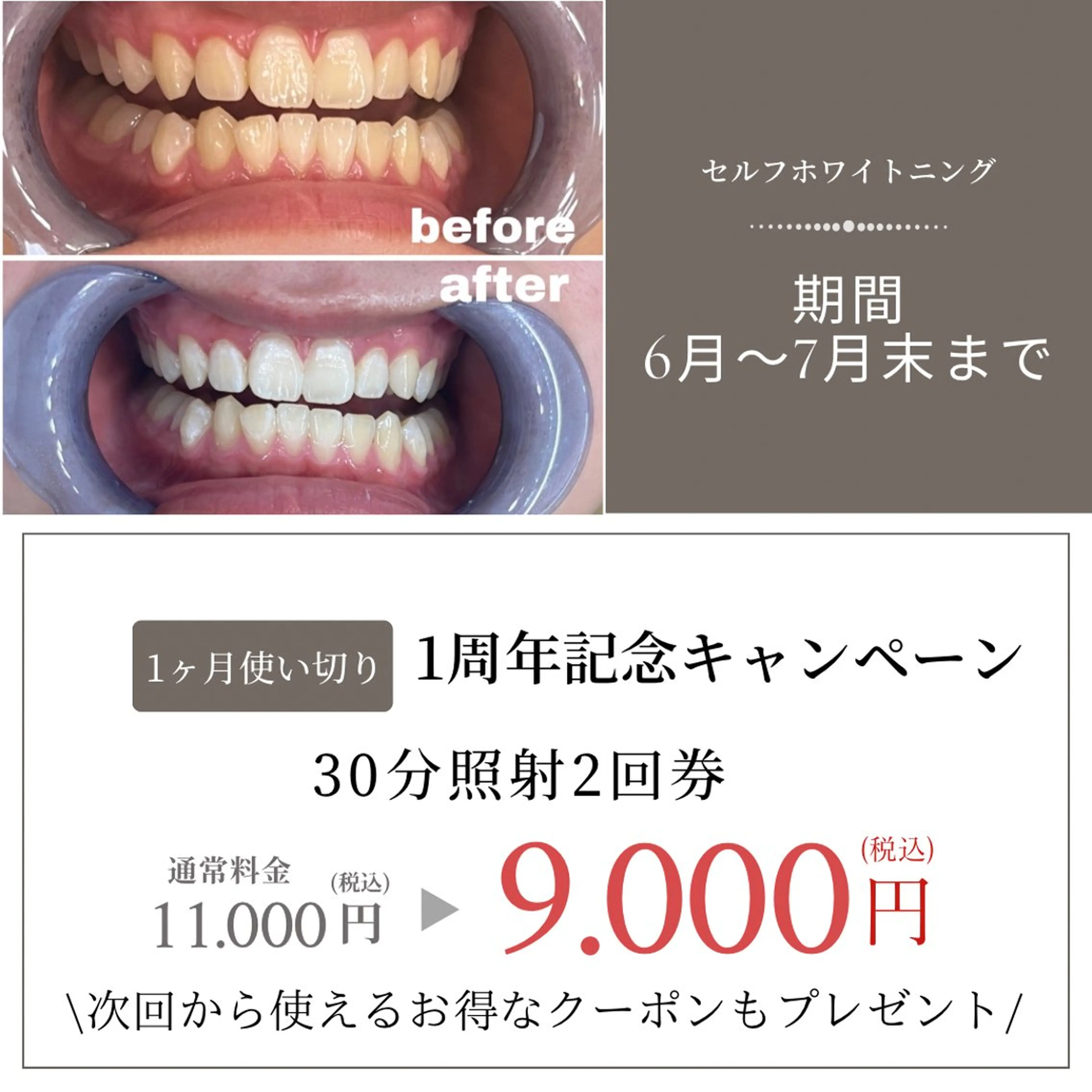 Akala. Uluのエステ・リラクイメージ