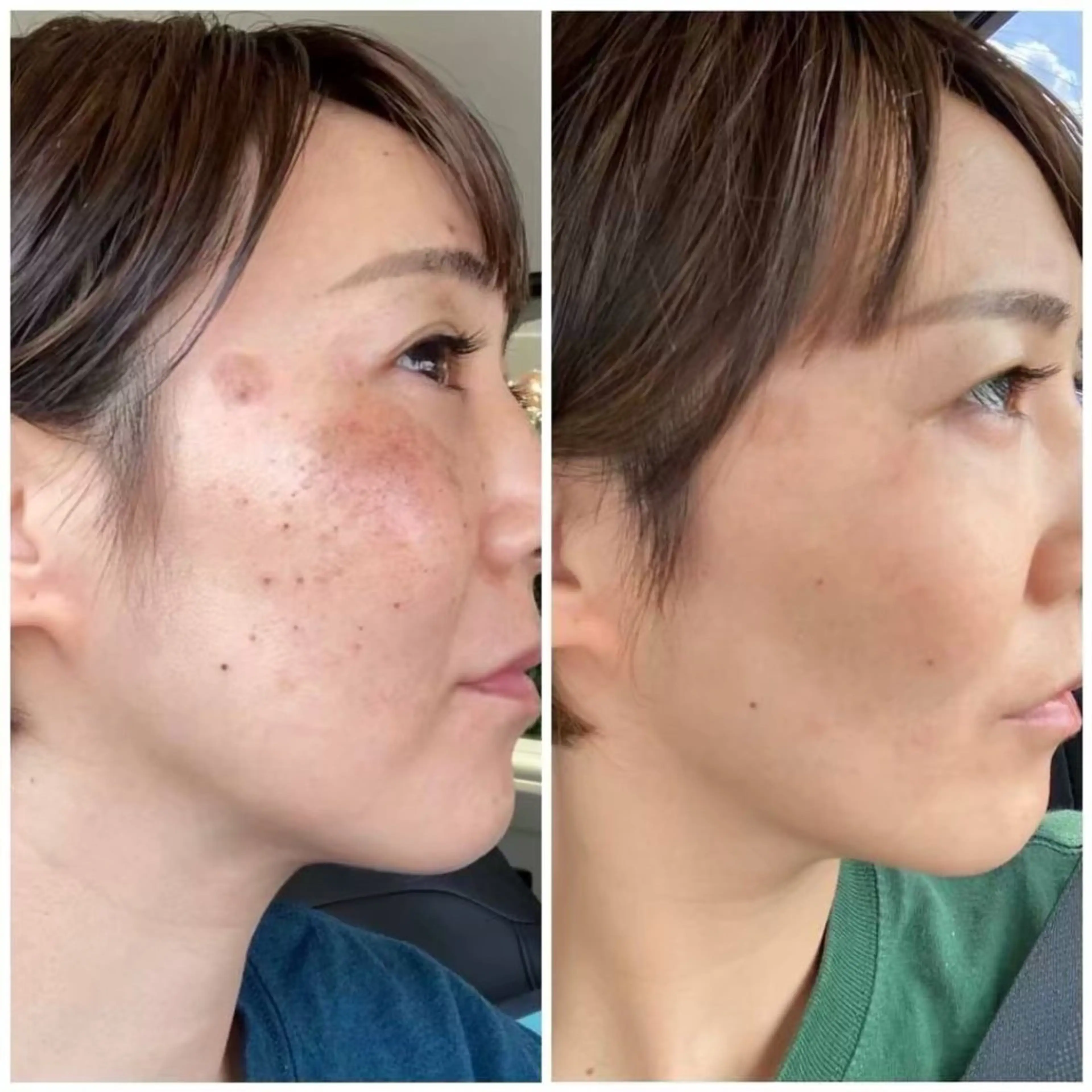 スリーエスプラス内　美肌サロンEme所属・希映 -kieのエステ・リラクイメージ