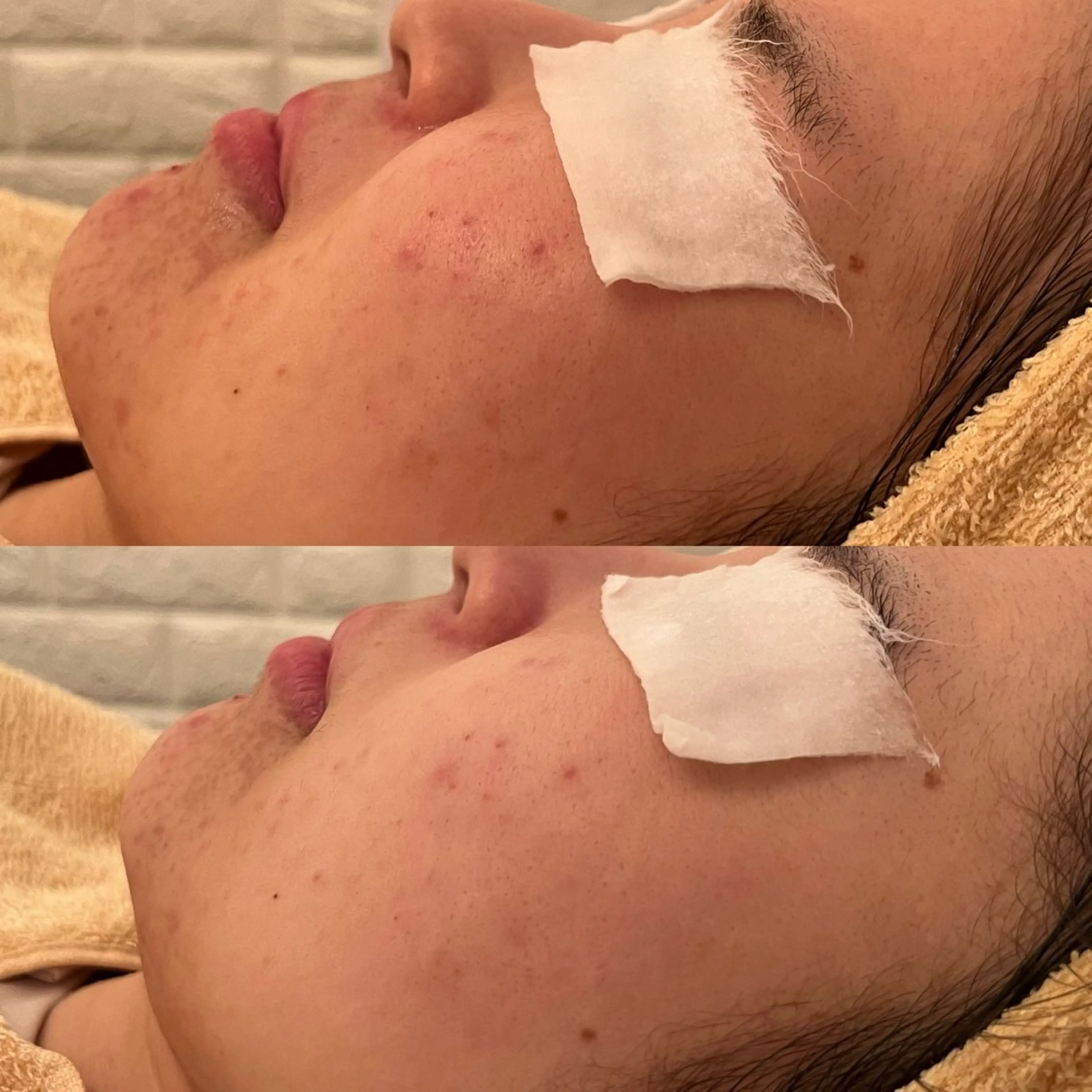 エステ リラク 毛穴ケア/毛穴診断/ 毛穴洗浄〔心斎橋〕のエステ・リラクイメージ