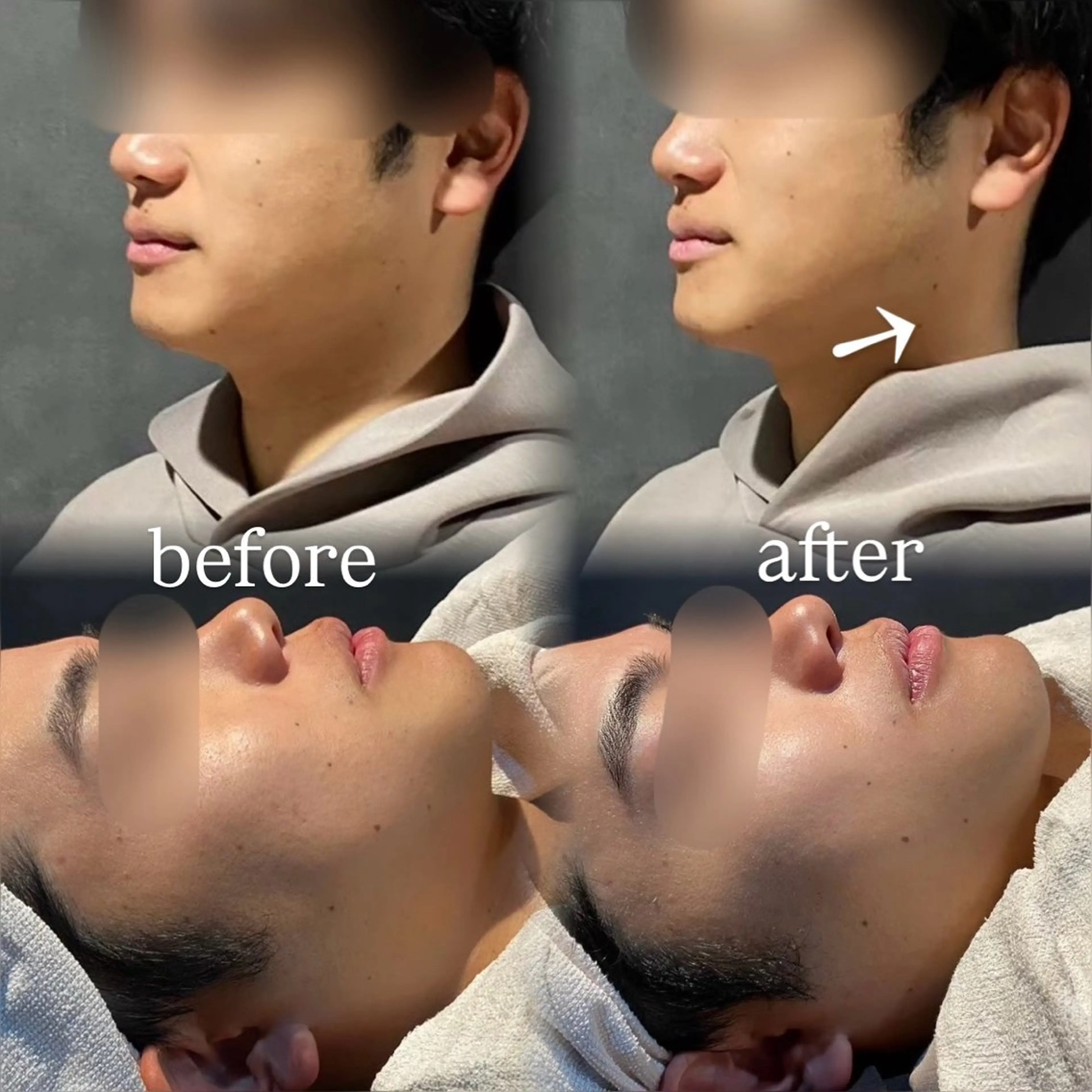 🪞Purasia. 🫧韓国肌管理💎の眉毛・アイブロウイメージ