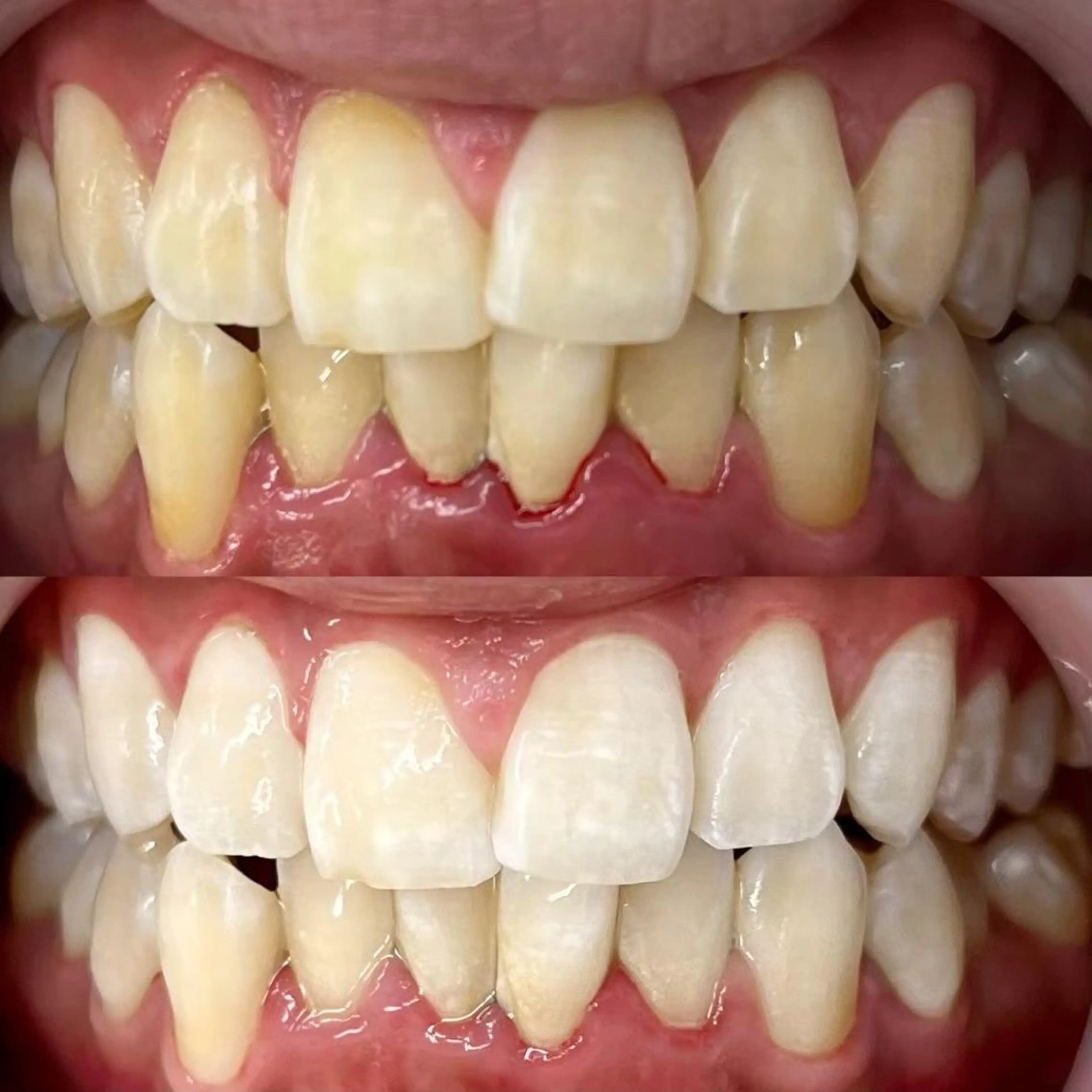 LBSホワイトニング 🌐梅田店公式のその他イメージ