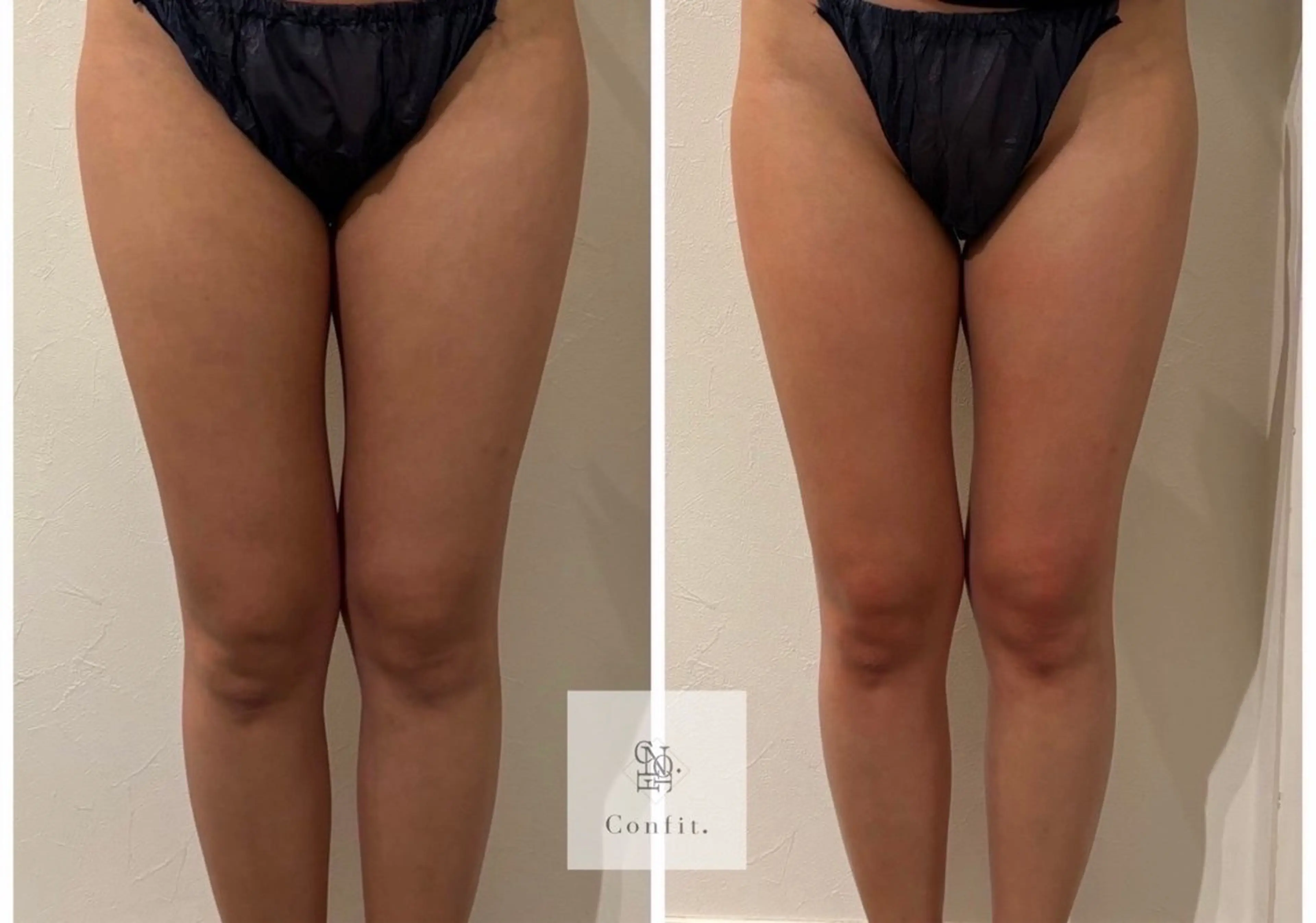 エステ 小顔/たるみ/黒ずみ除去専門サロン/SONA 大和西大寺店所属・【小顔痩身専門看護師 サロンSONA】のエステ・リラクイメージ