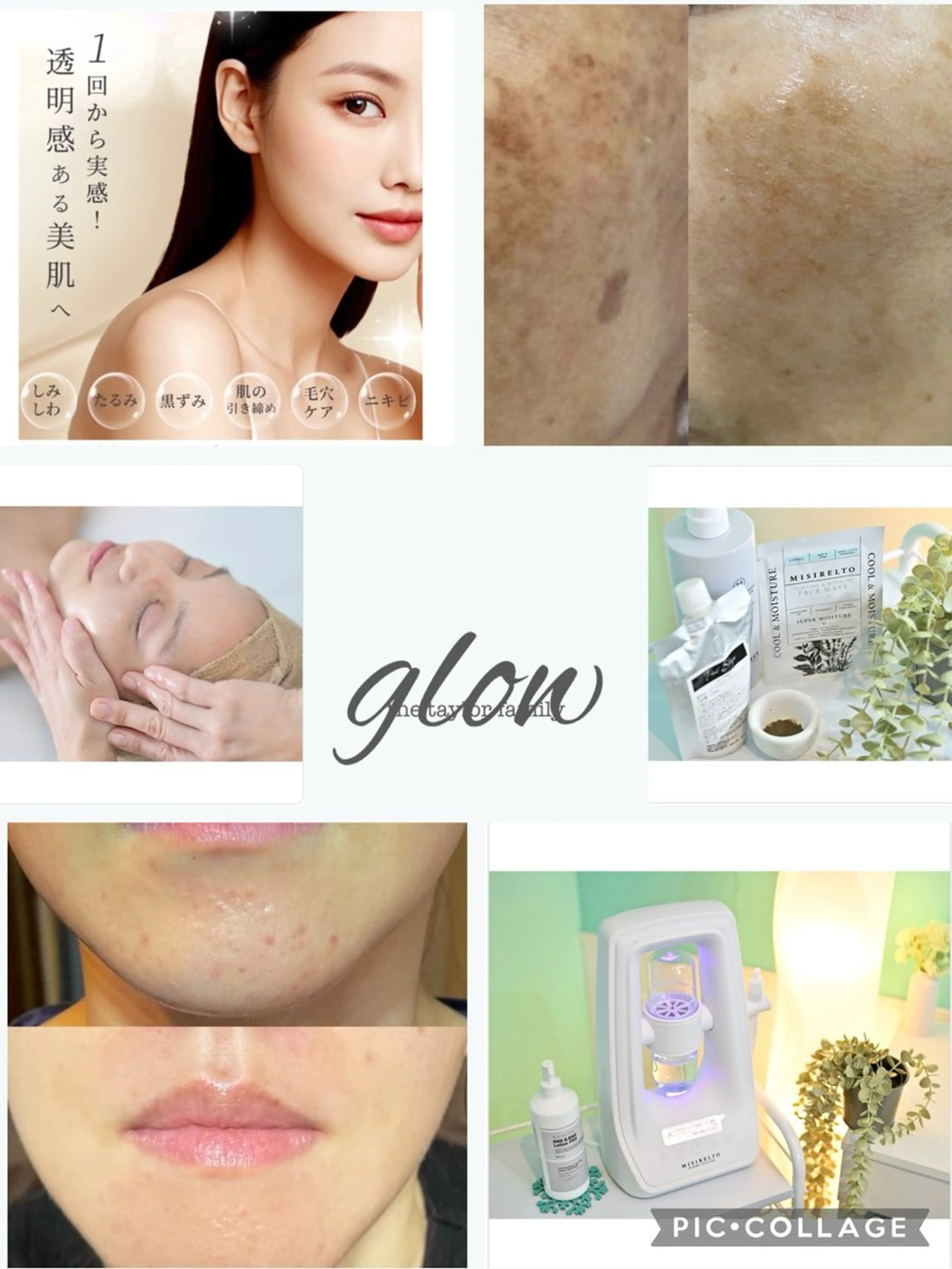 【医療提携】幹細胞艶玉ハーブピーリング　glow所属・肌質改善専門 【医療提携】glowのエステ・リラクイメージ