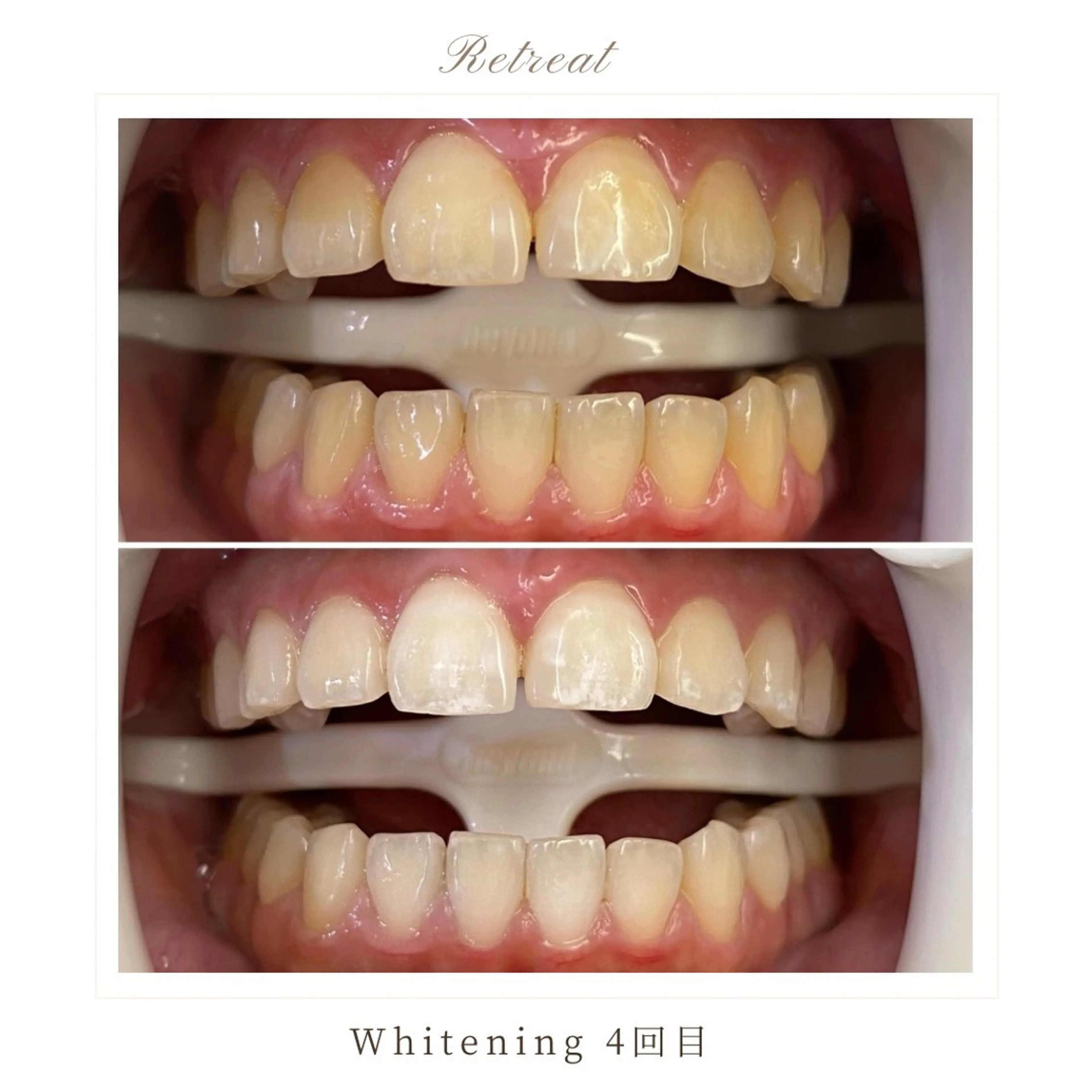 メンズ キッズ Retreatリトリート所属・歯科医院提携 Retreatのエステ・リラクイメージ