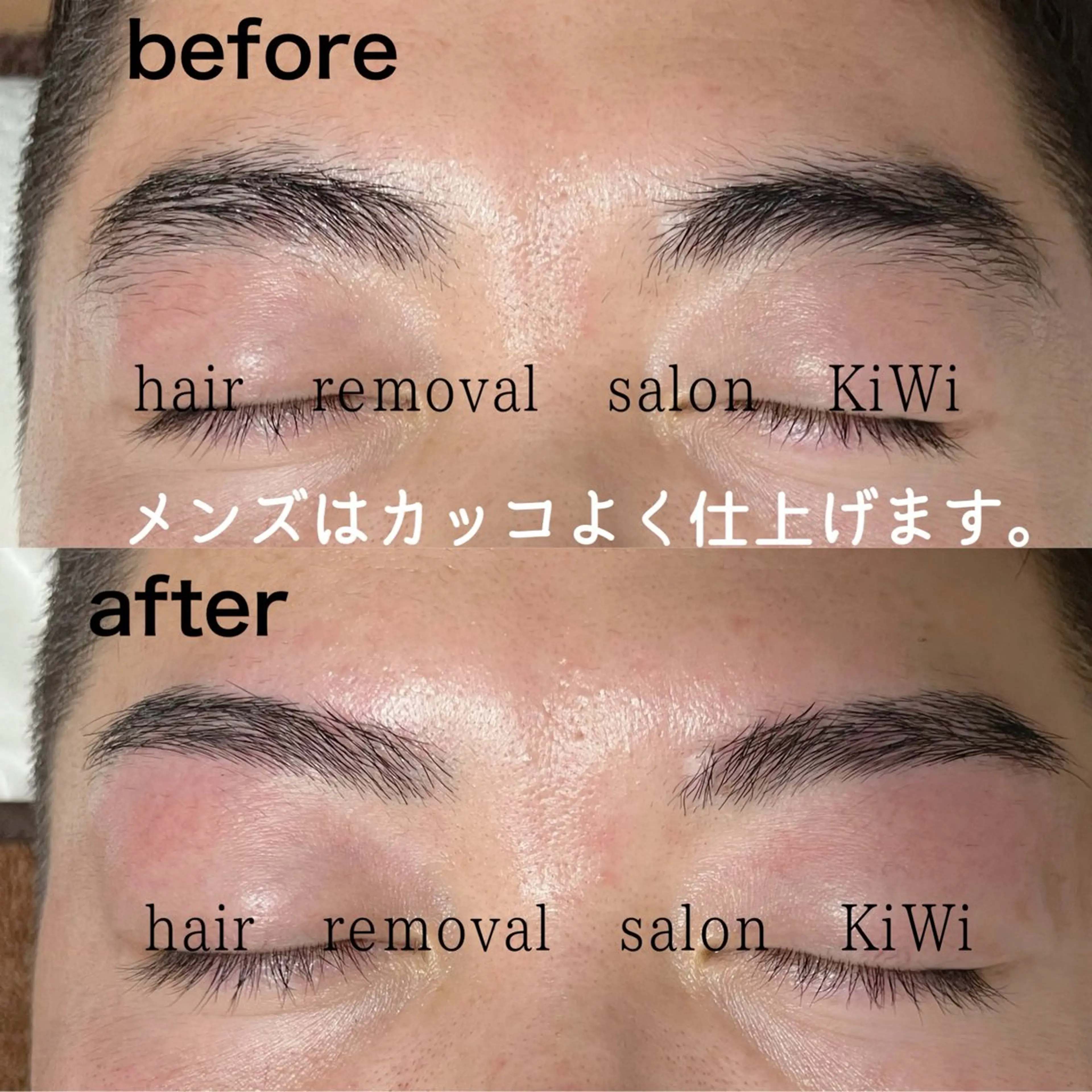 アイブロウ メンズアイブロウ 脱毛サロン KiWiのエステ・リラクイメージ
