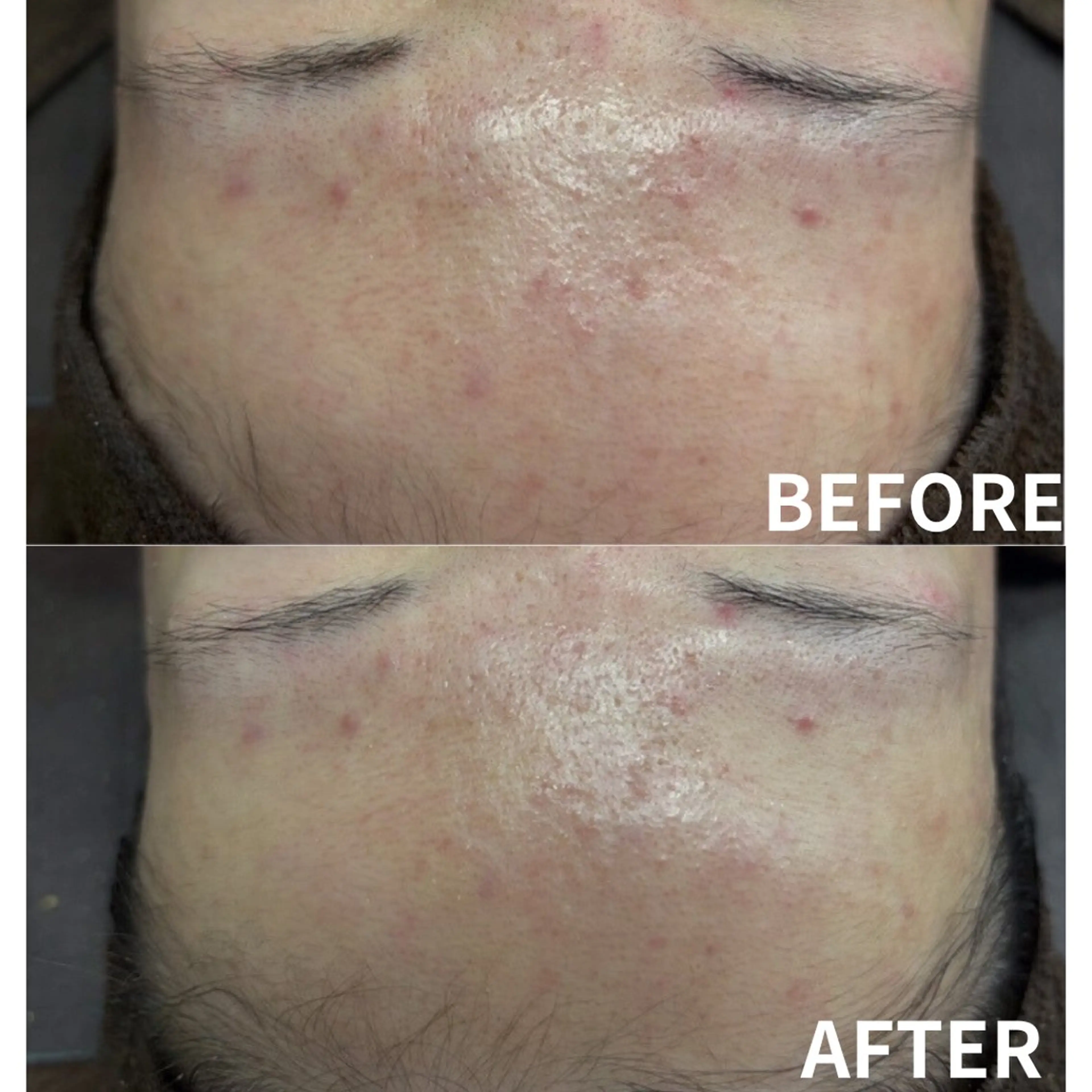 エステ yomu所属・yomu Rikaのエステ・リラクイメージ