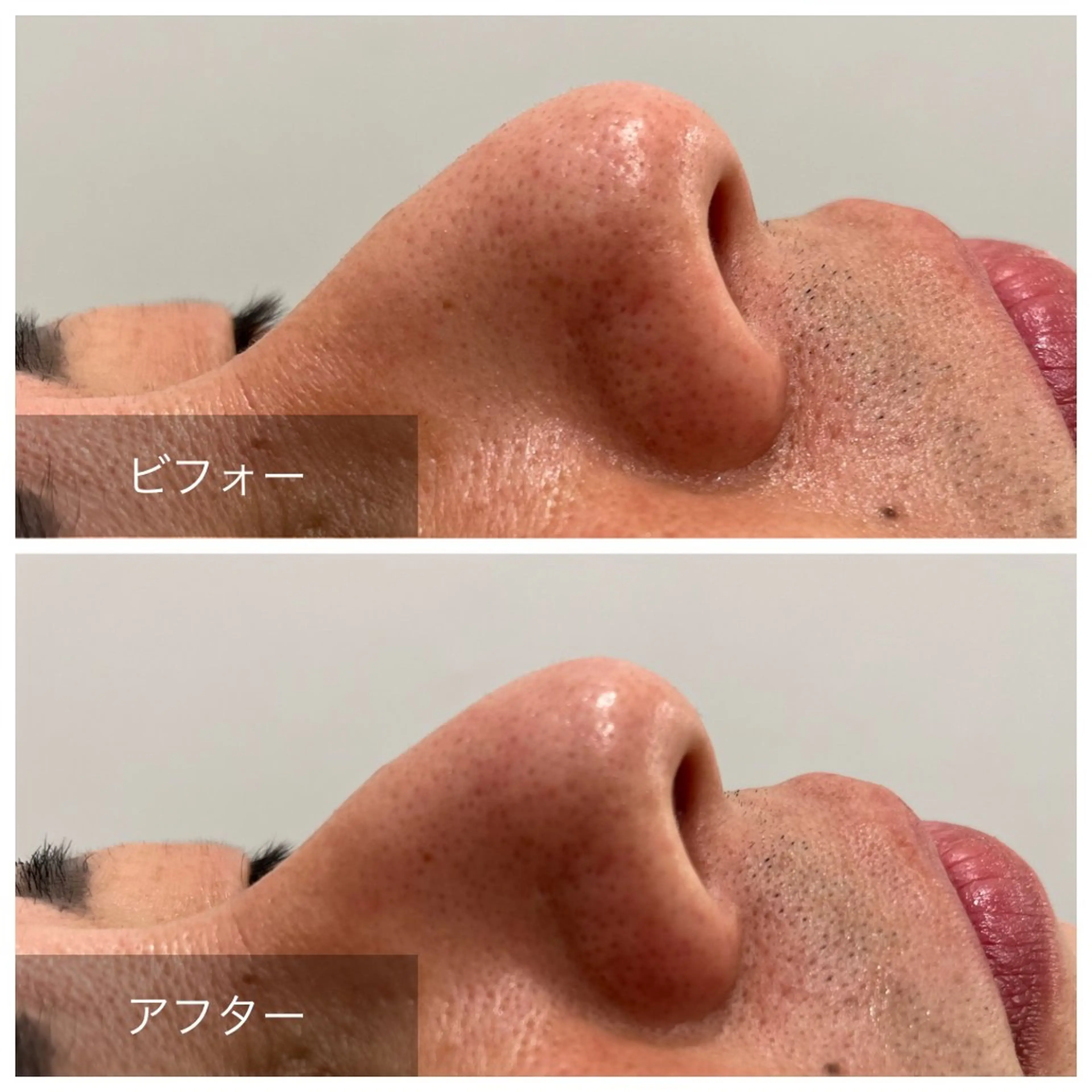 Relaxsalon undo所属・Relaxsalon undoのエステ・リラクイメージ