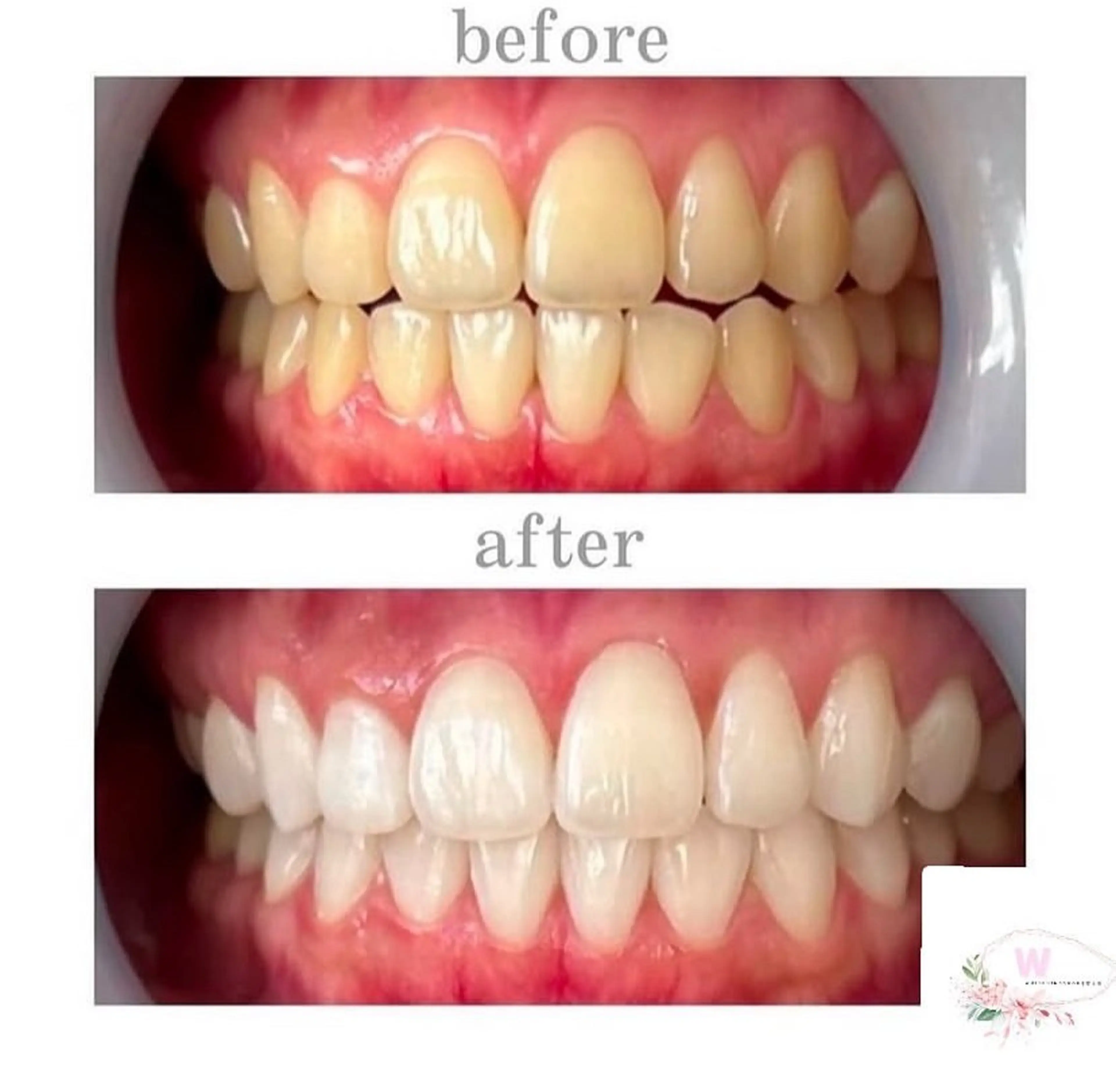 ホワイトニング ショップ本厚木のその他イメージ