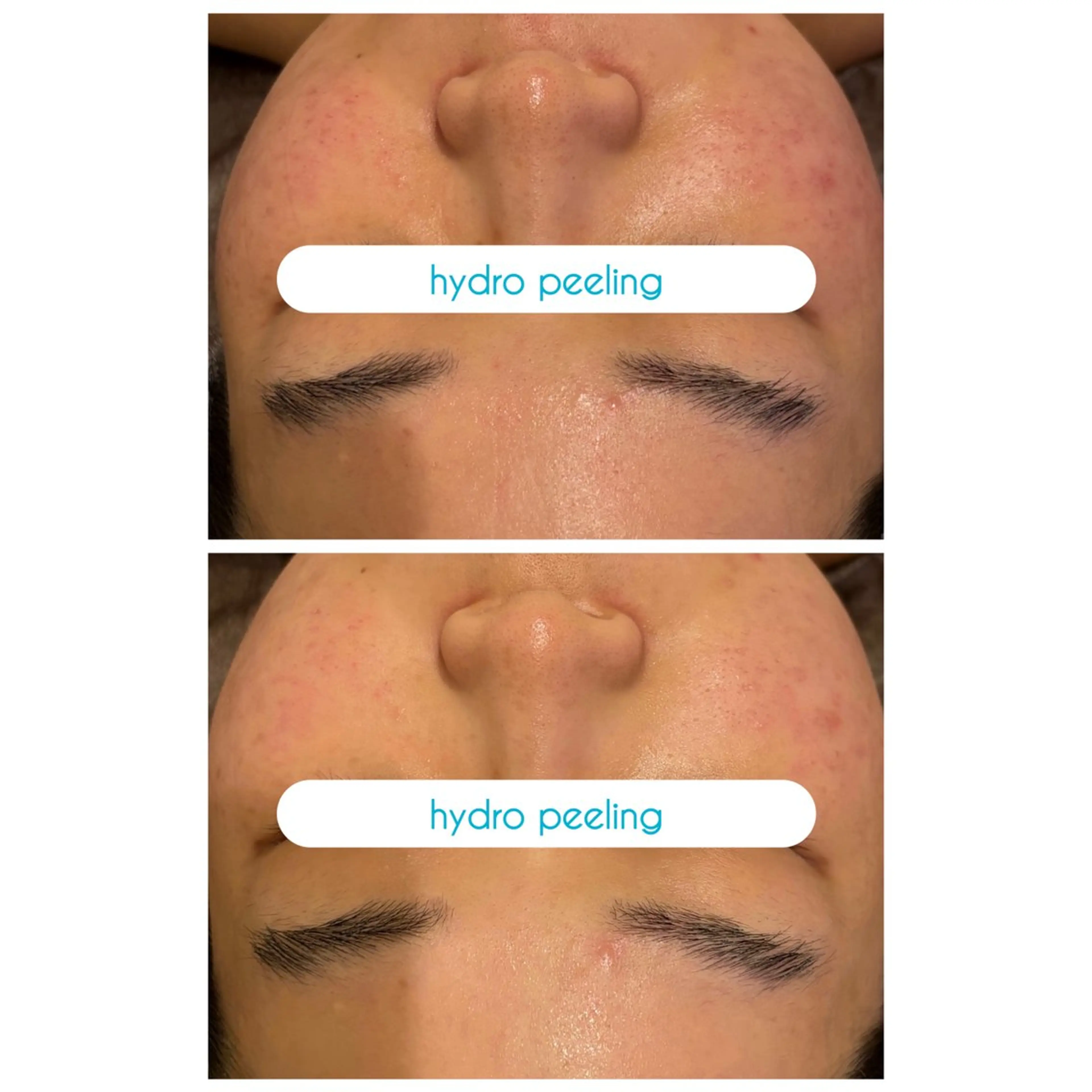 ☆痩身/小顔☆ 結果出します☆のエステ・リラクイメージ