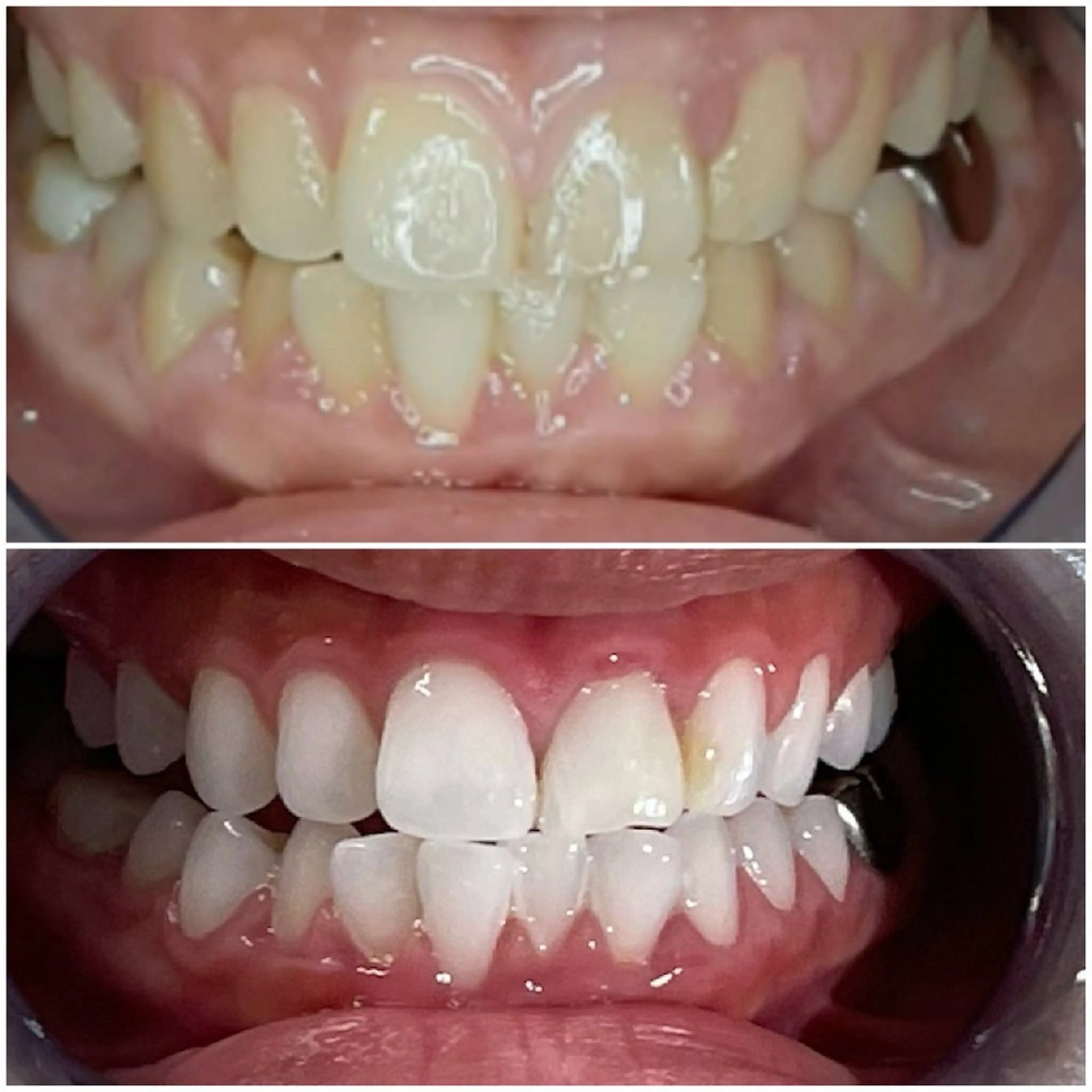 五十嵐 蓮のその他イメージ