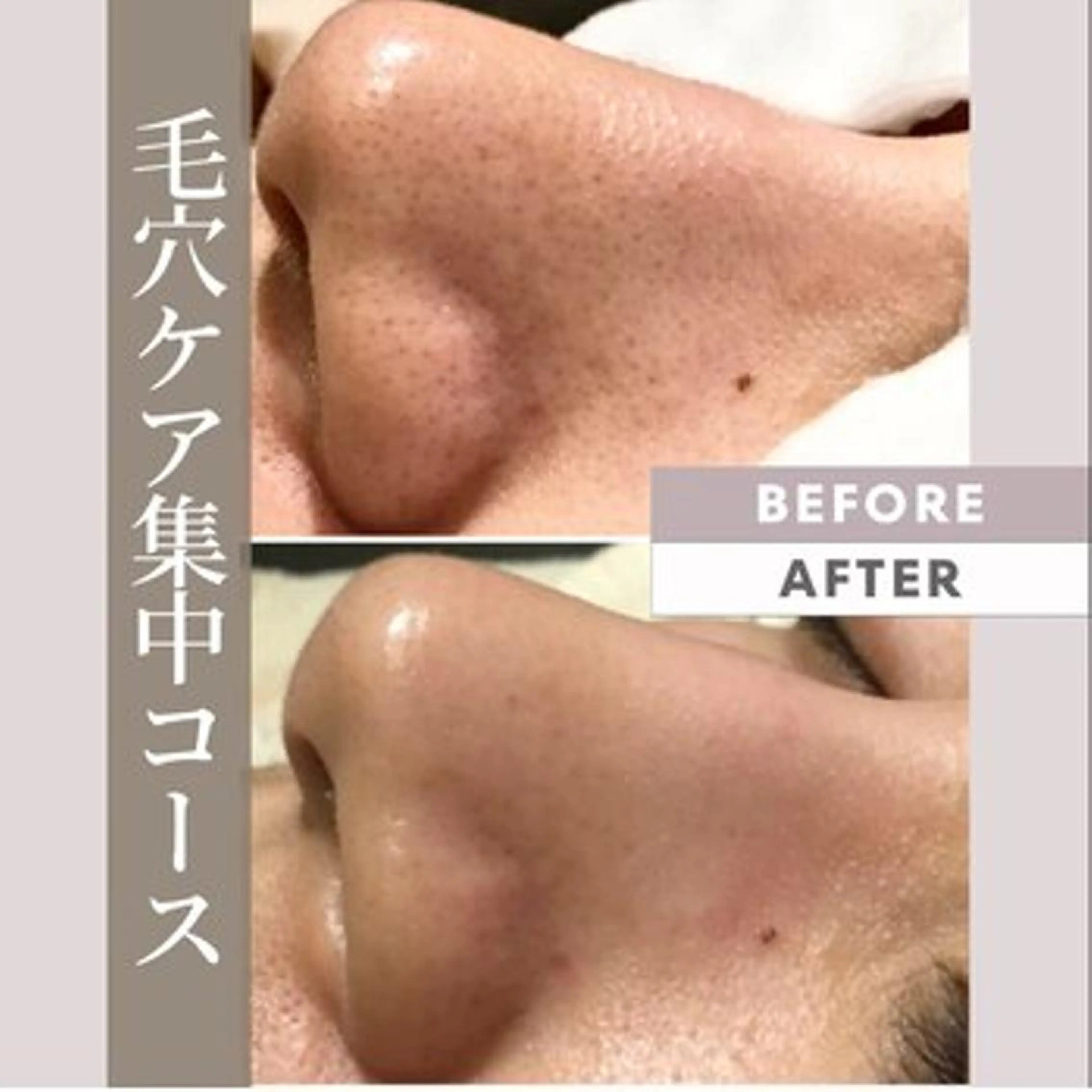 【毛穴汚れ・ザラつき改善】毛穴洗浄Face60分☆14300円→7700円の写真