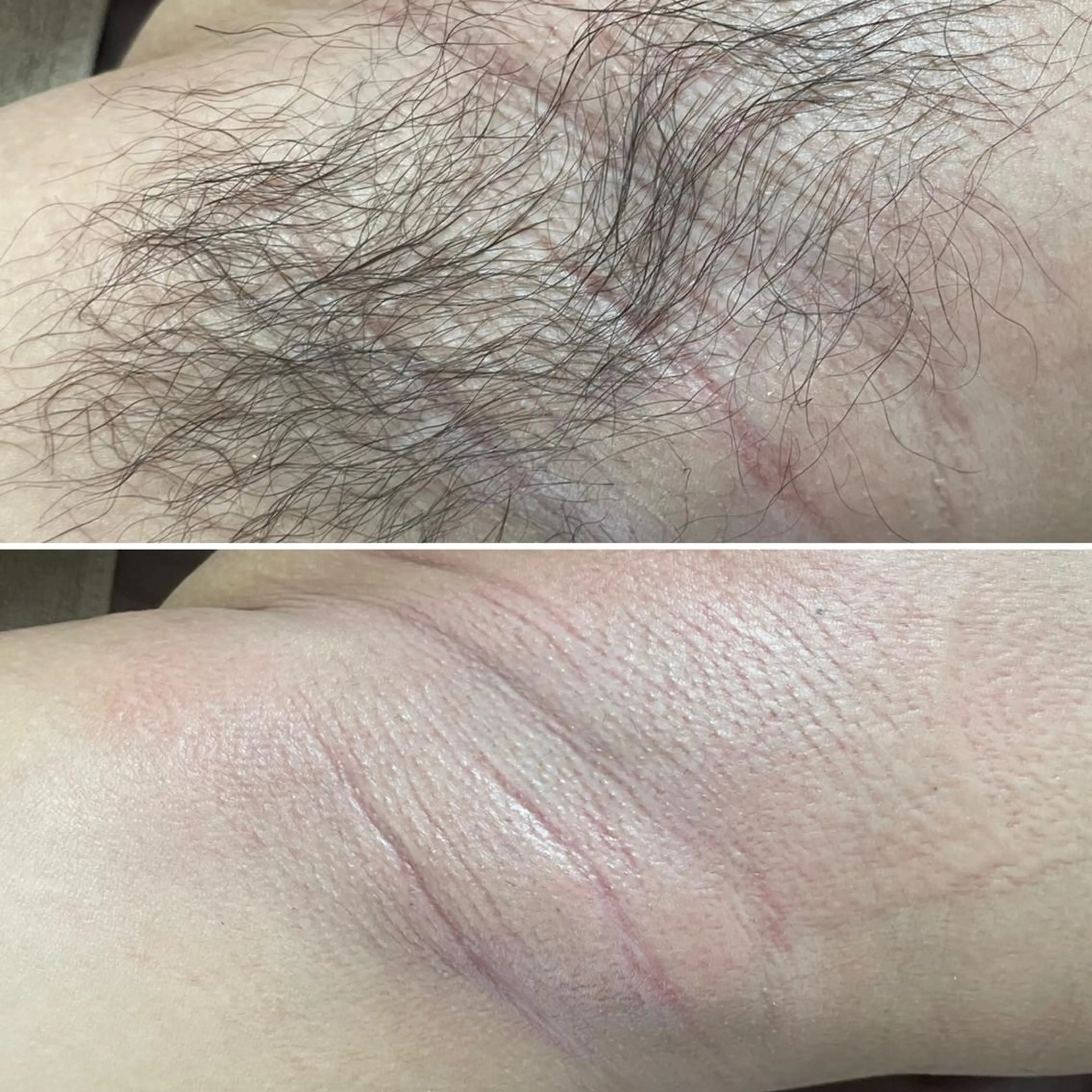 アイブロウ メンズ キッズ 脱毛 Epina 千葉店 【エピナ】のエステ・リラクイメージ