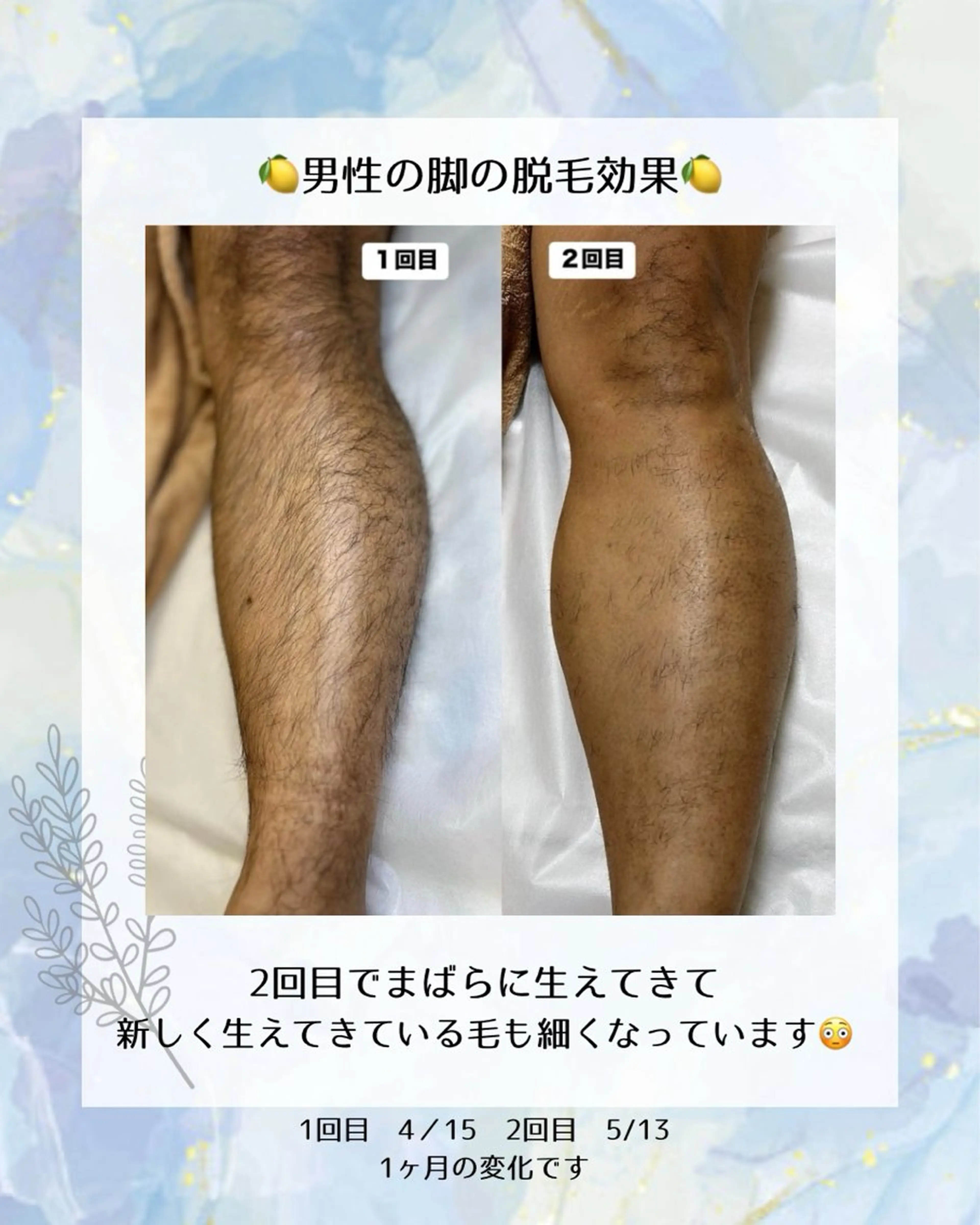 メンズ エステサロン lx (ルクス)所属・エステサロン lx(ルクス)のエステ・リラクイメージ