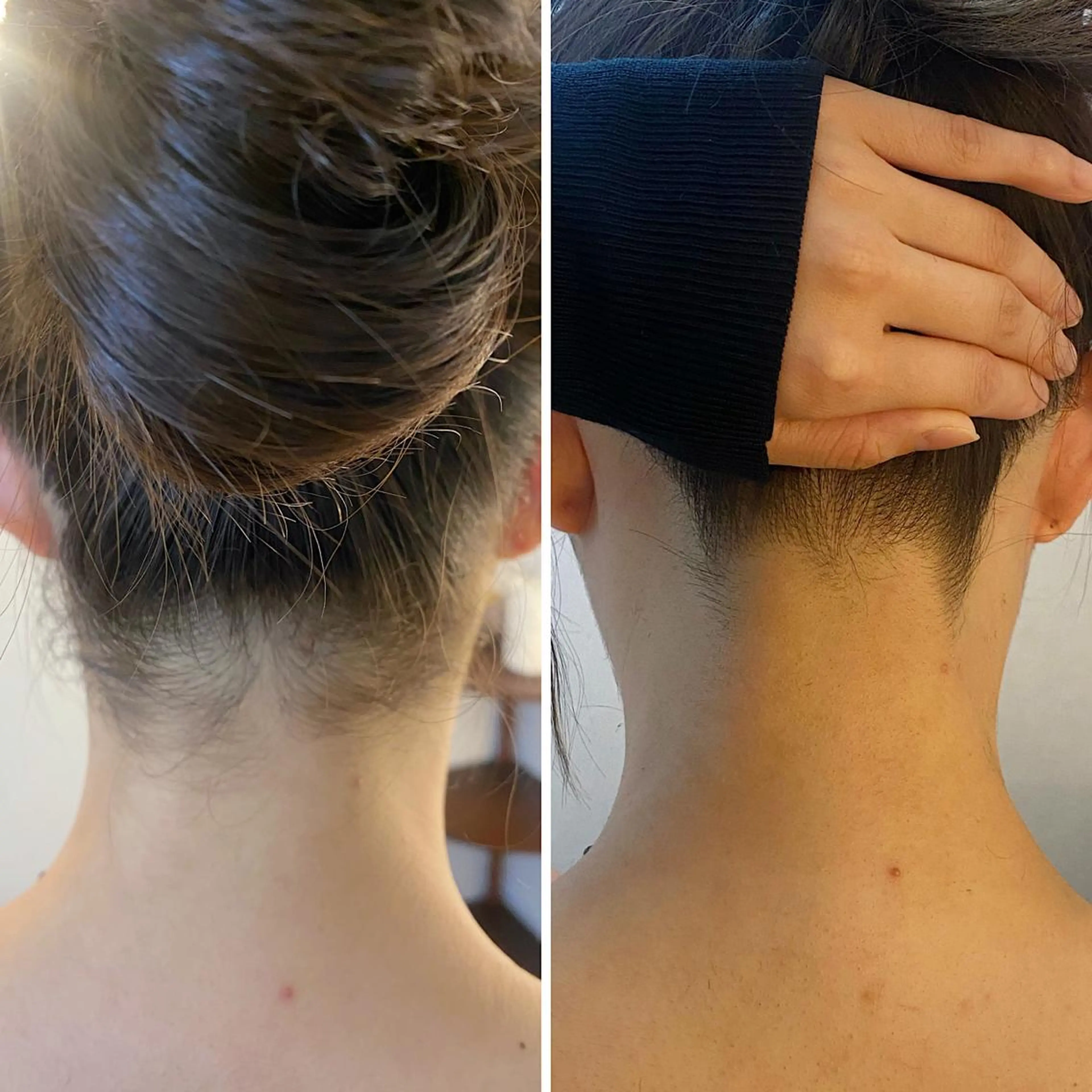 脱毛 うなじ脱毛/美肌脱毛 LABELのエステ・リラクイメージ