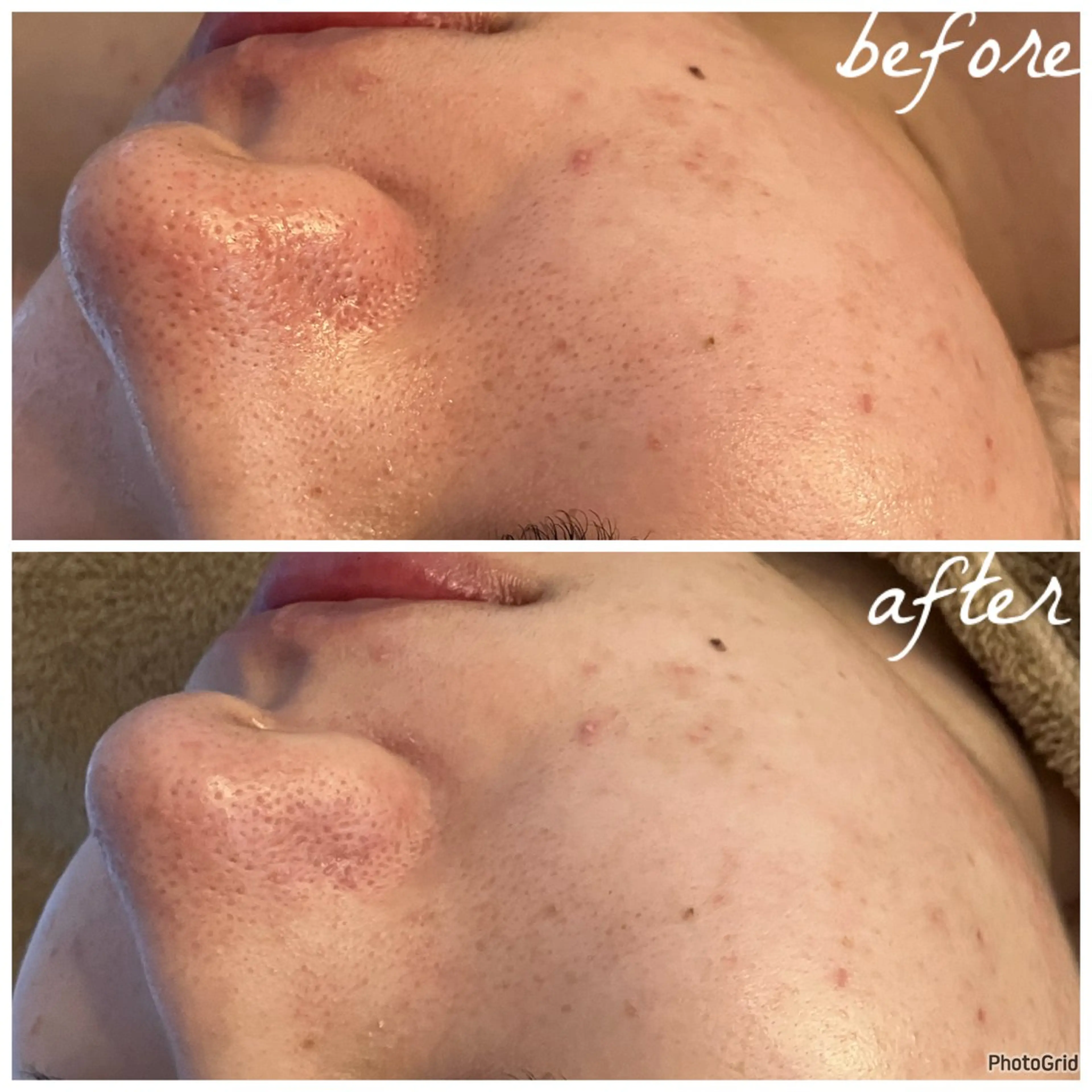 メンズ エステ メナード岐阜茜部 杉浦のエステ・リラクイメージ