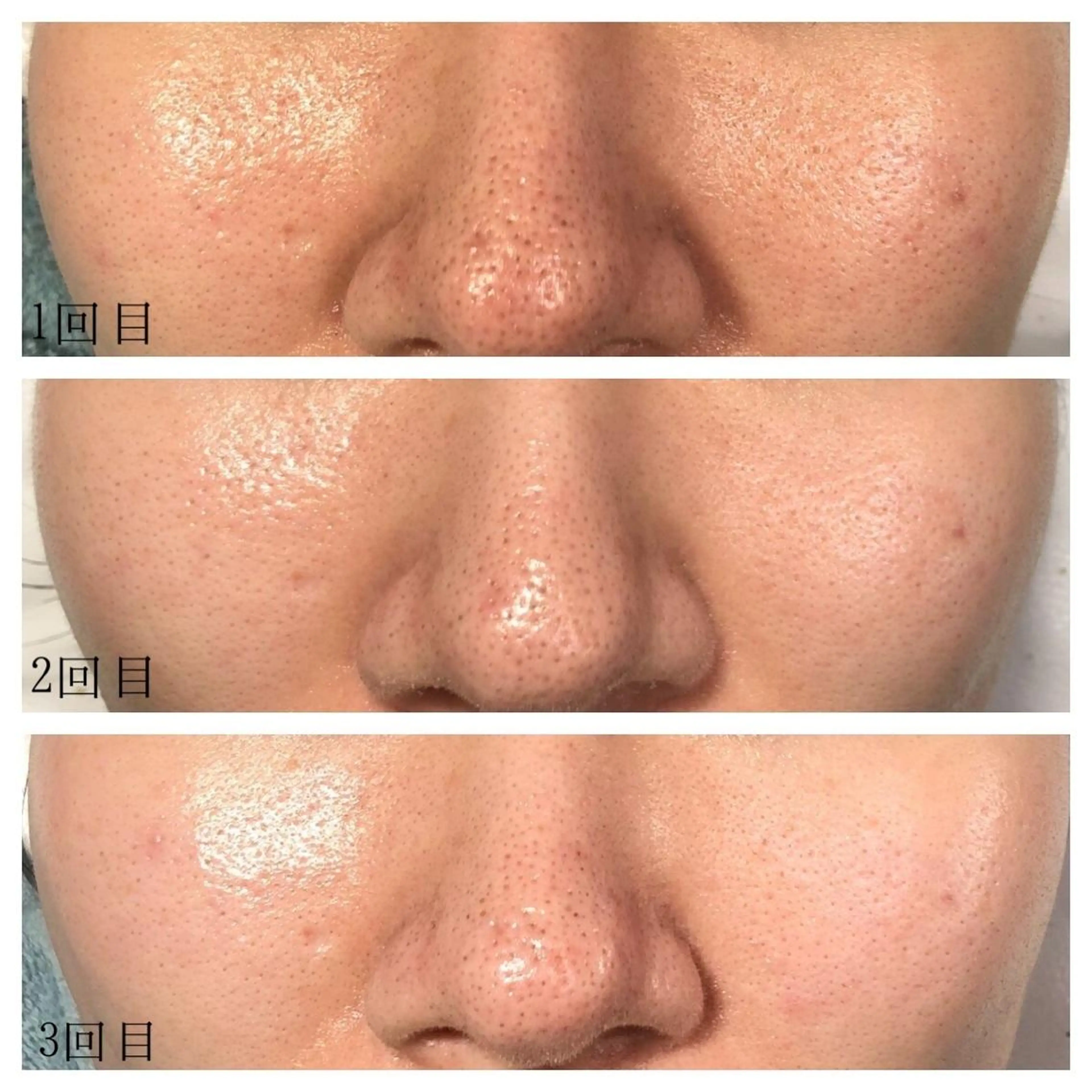 kapua所属・Kapua🌺 マユのマツエク・マツパデザイン