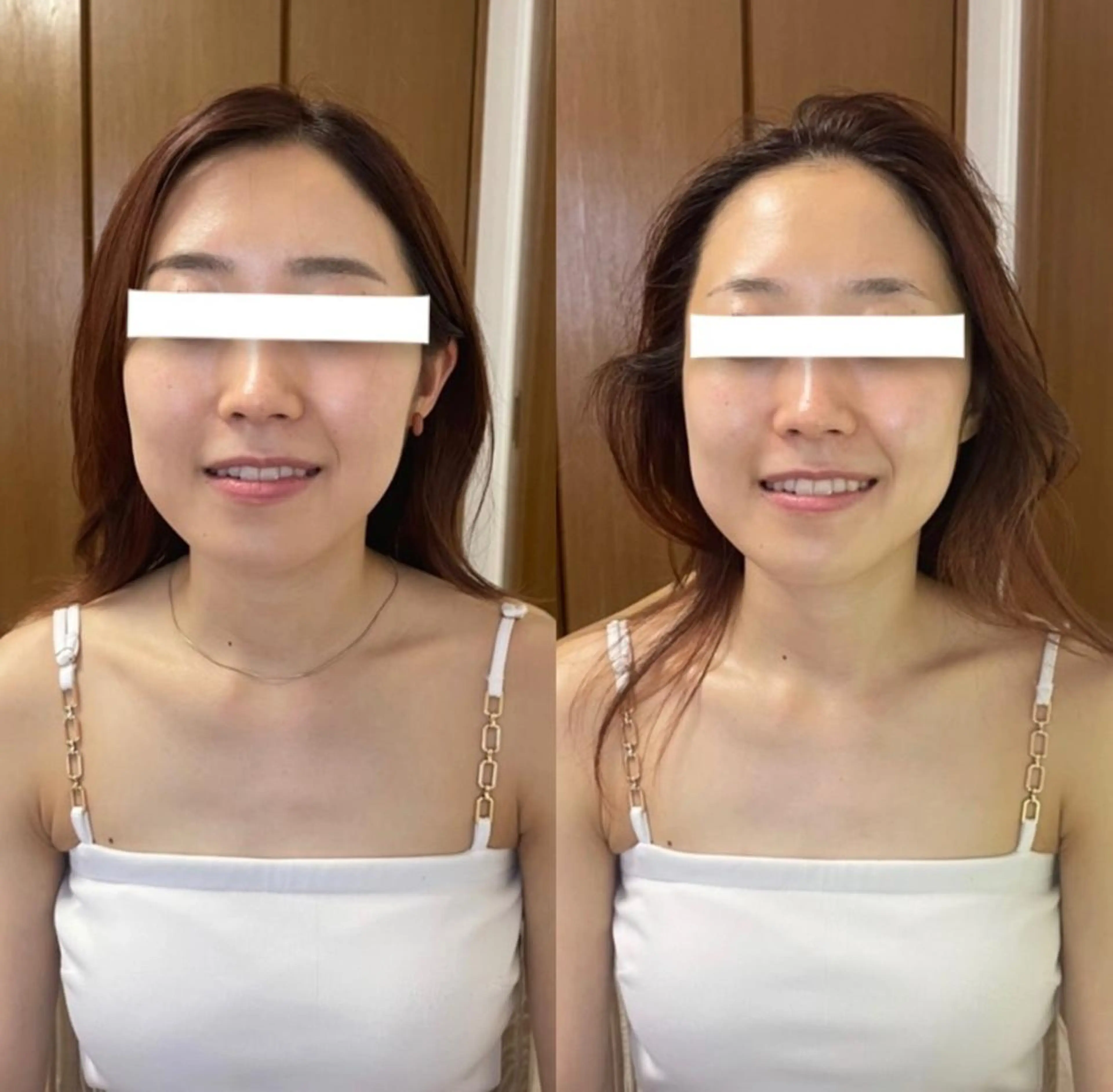 透明感の肌Lino malieのエステ・リラクイメージ