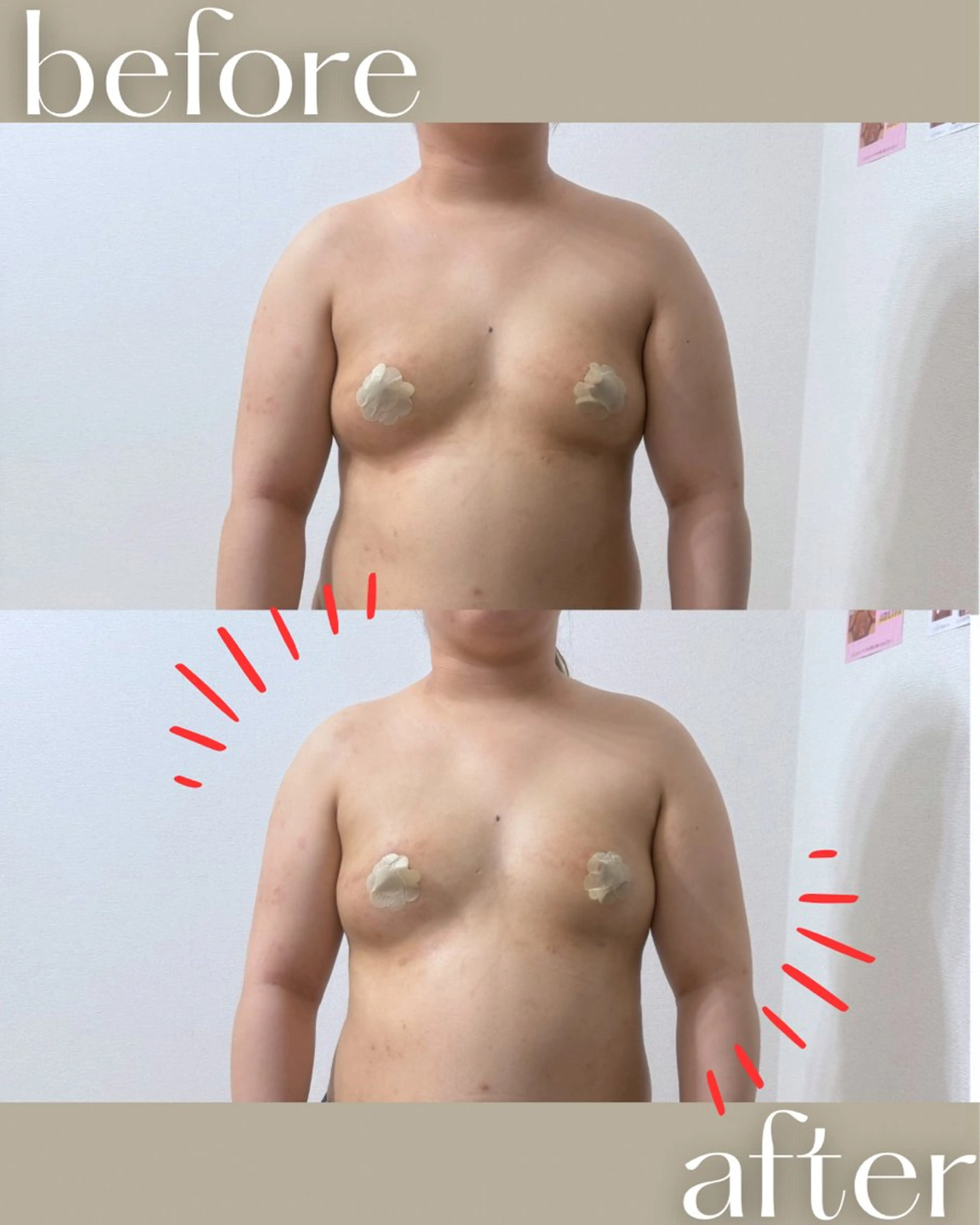 バストケア専門店| canyのエステ・リラクイメージ