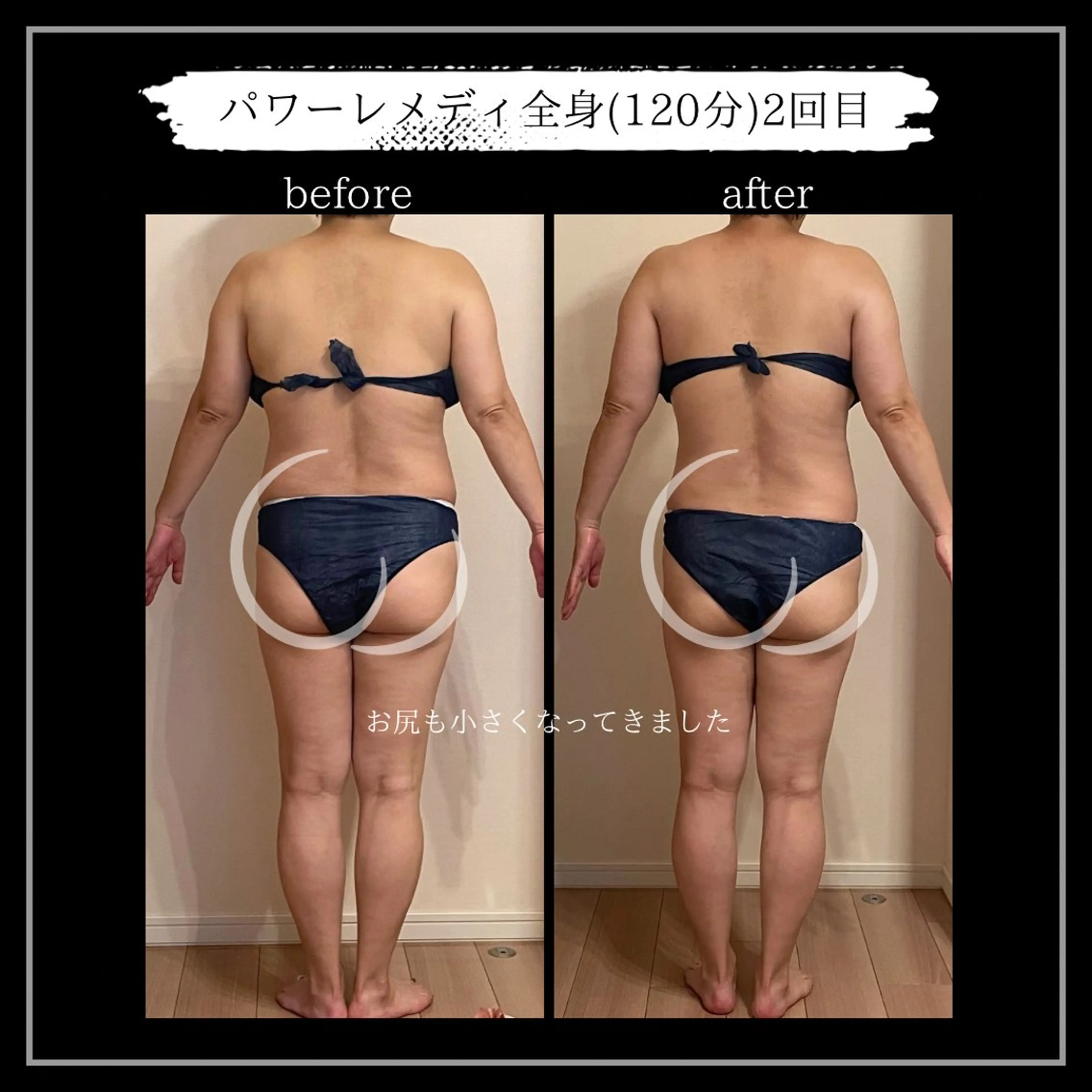 オフ:オン所属・オフ:オン 全身筋膜マッサージのエステ・リラクイメージ