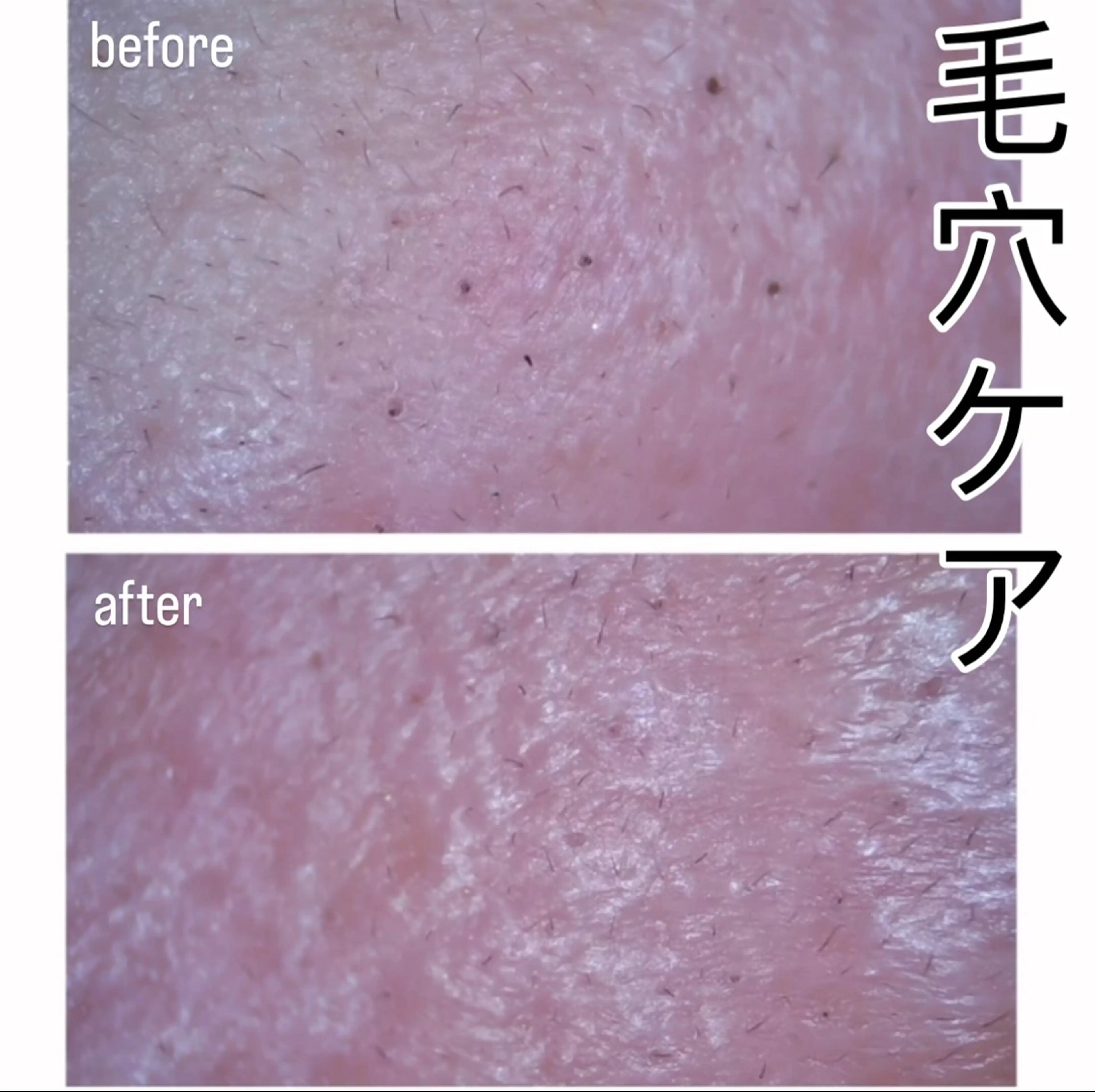 DISINI  SPA所属・DISINISPA 脱毛/フェイシャルのエステ・リラクイメージ