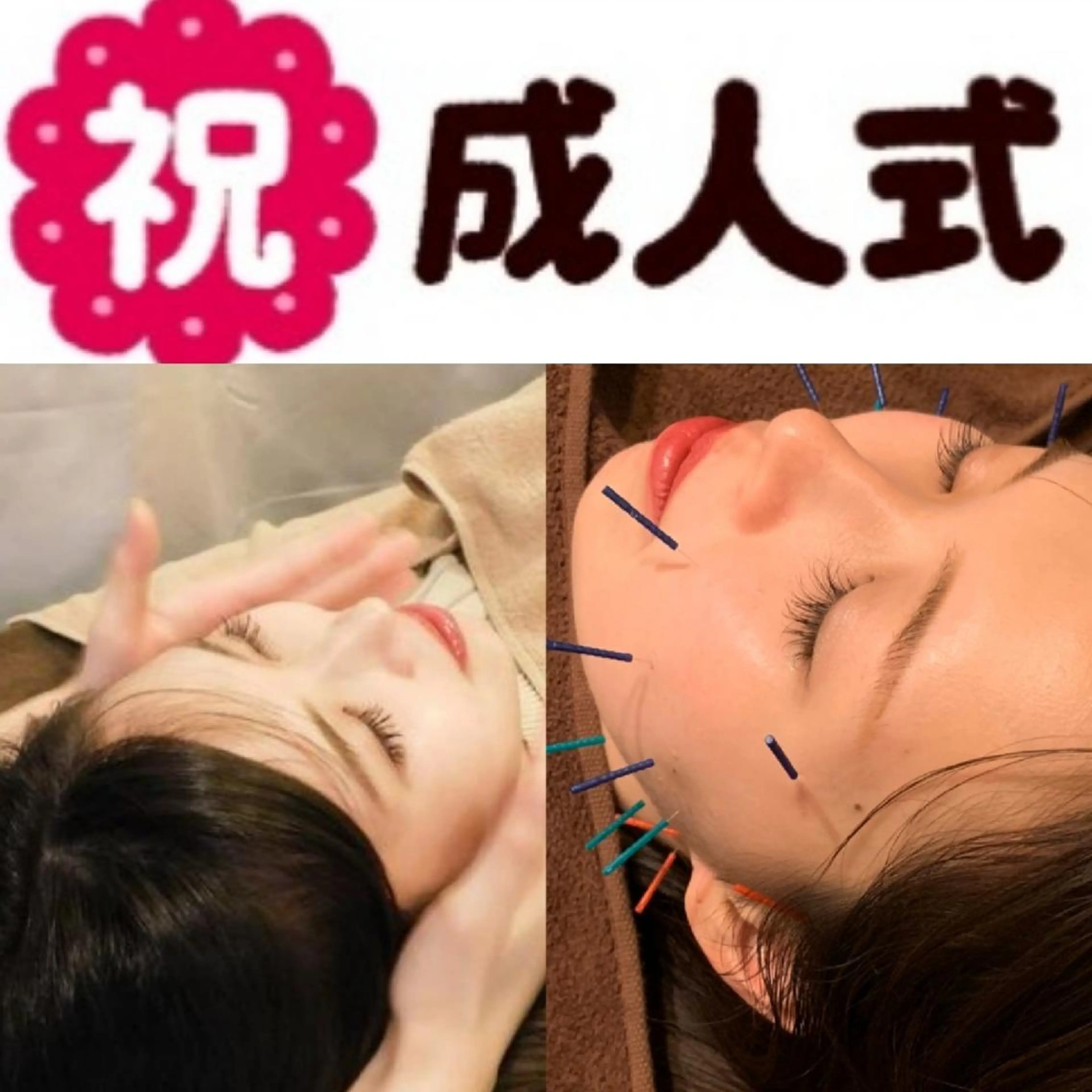 たるみ専門美容鍼 × 猫背整体 のぐち所属・小顔と姿勢改善のプロ ｜整体と美容鍼のぐちのエステ・リラクイメージ