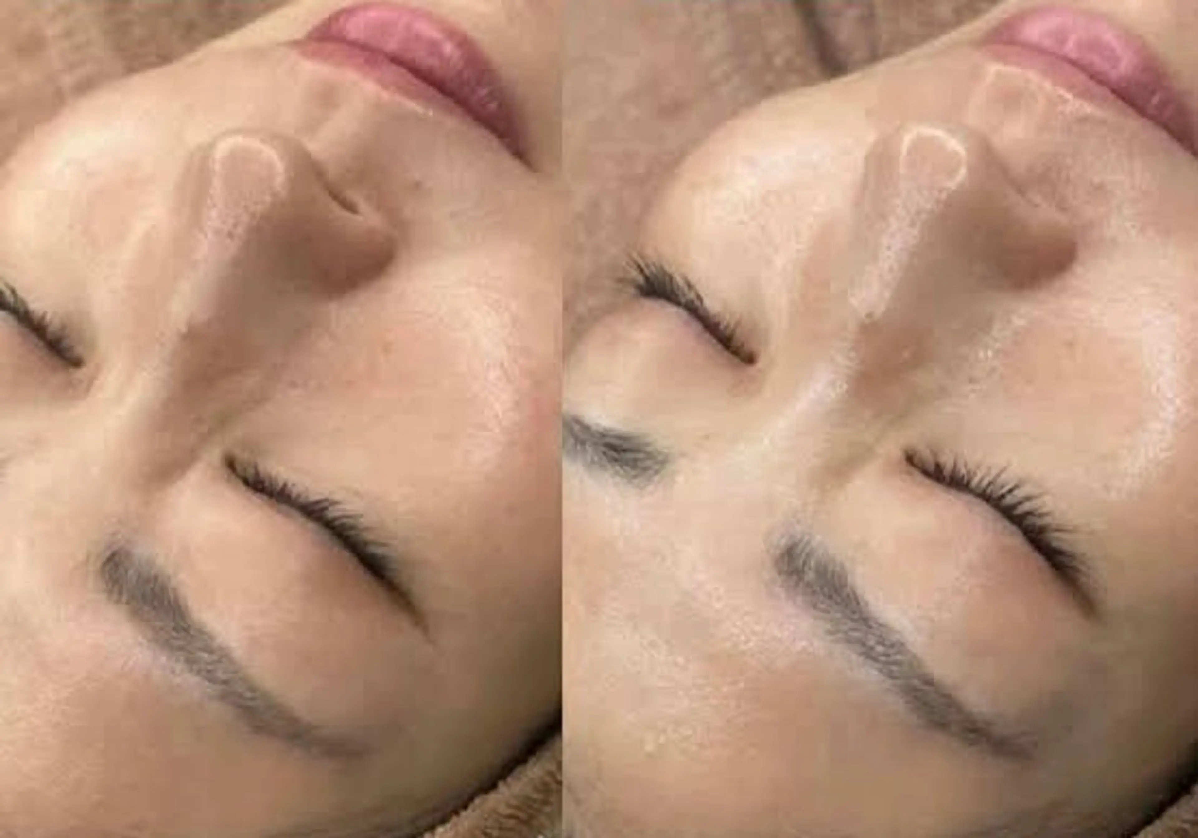 ララピールより美白肌育UP◎プラチナプラピール【2set6回分】8,000円 ララピール進化版プラピール 美白、アンチエイジング、艶肌｜都度払い