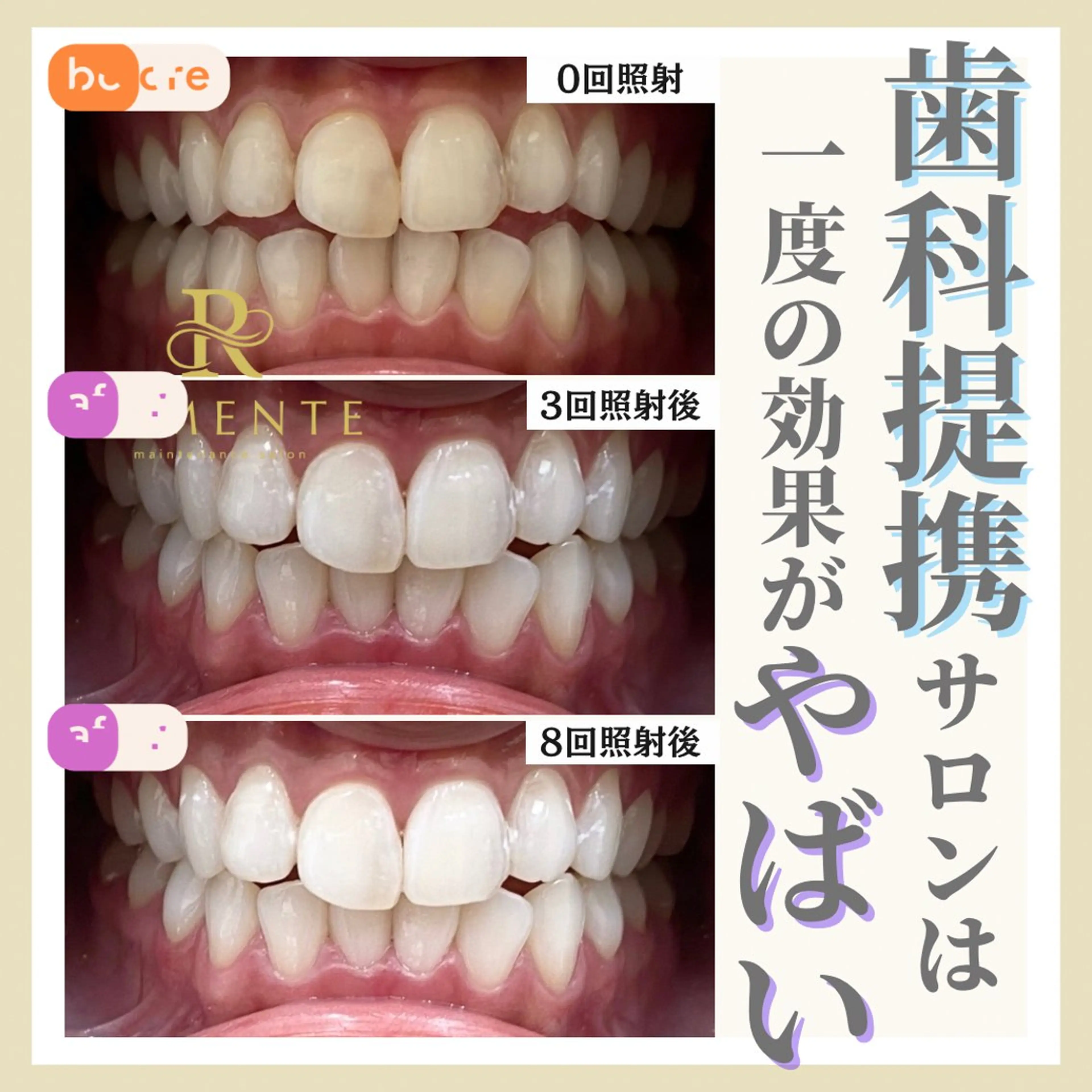 天神ホワイトニングスタジオ所属・天神ホワイトニング スタジオ大名店のその他イメージ