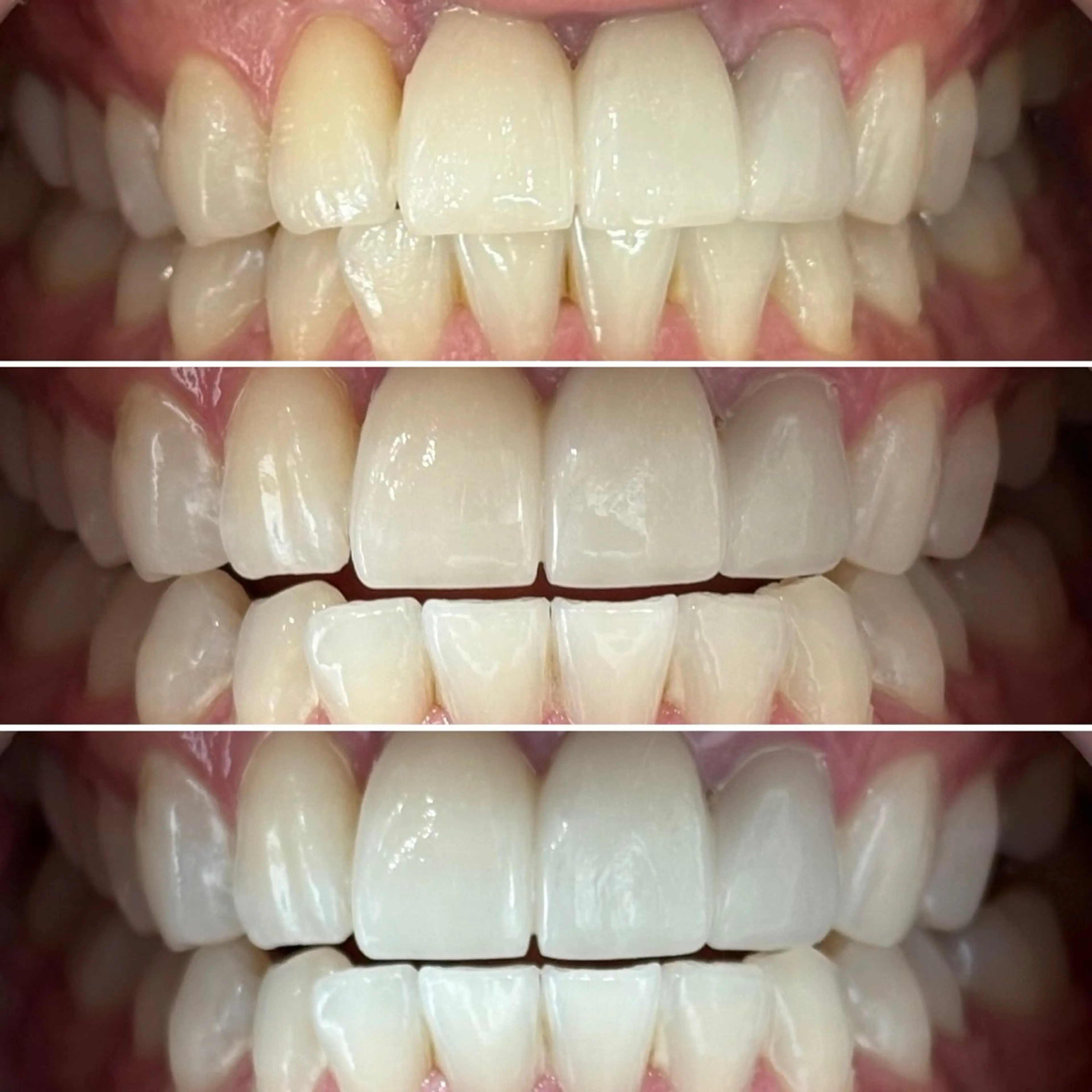 その他 whitening salon yatto.所属・ホワイトニングサロン yatto.のその他イメージ