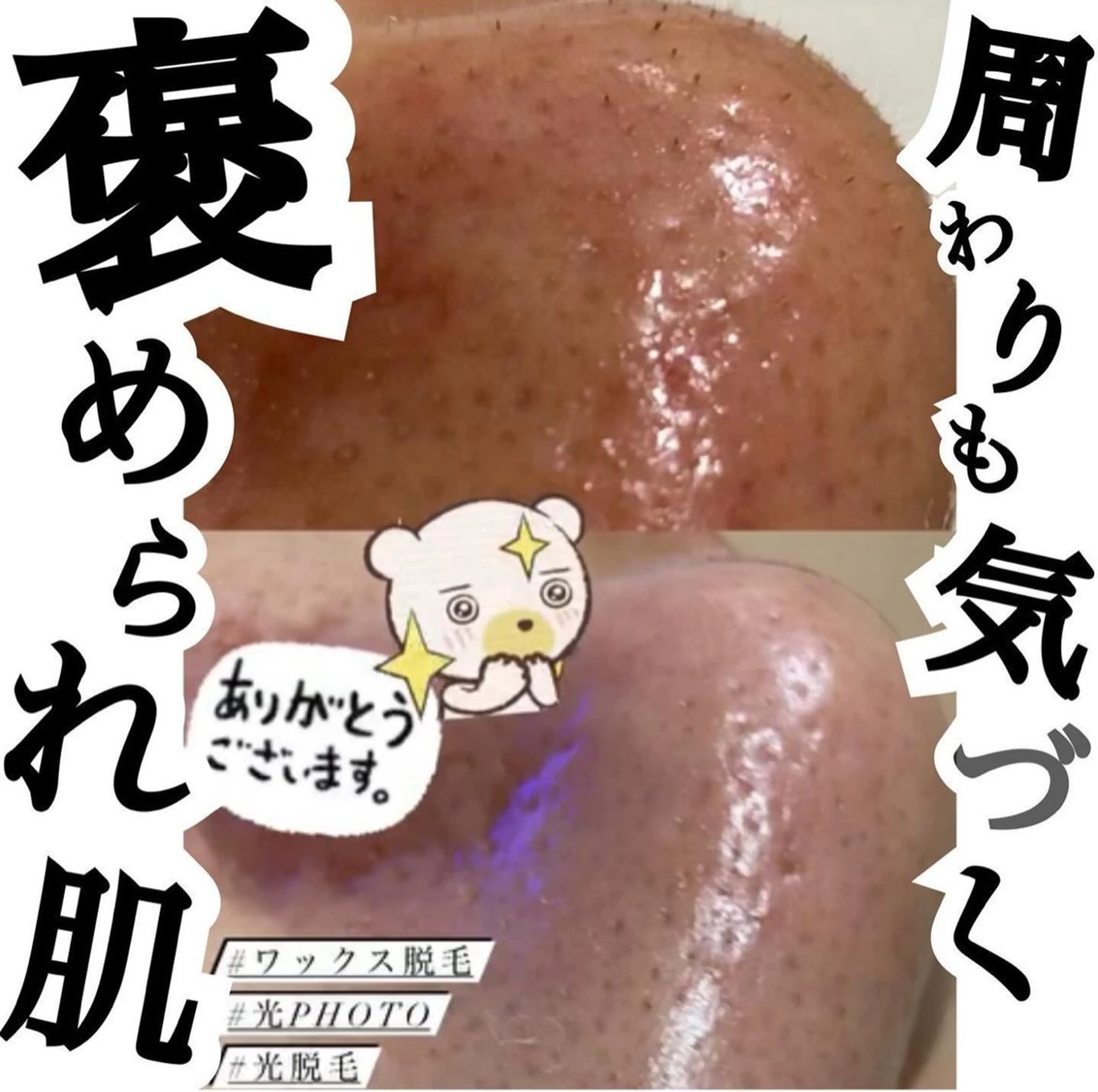 aroma  YURARI所属・韓国艶美人// 毛穴ケア🌹のエステ・リラクイメージ