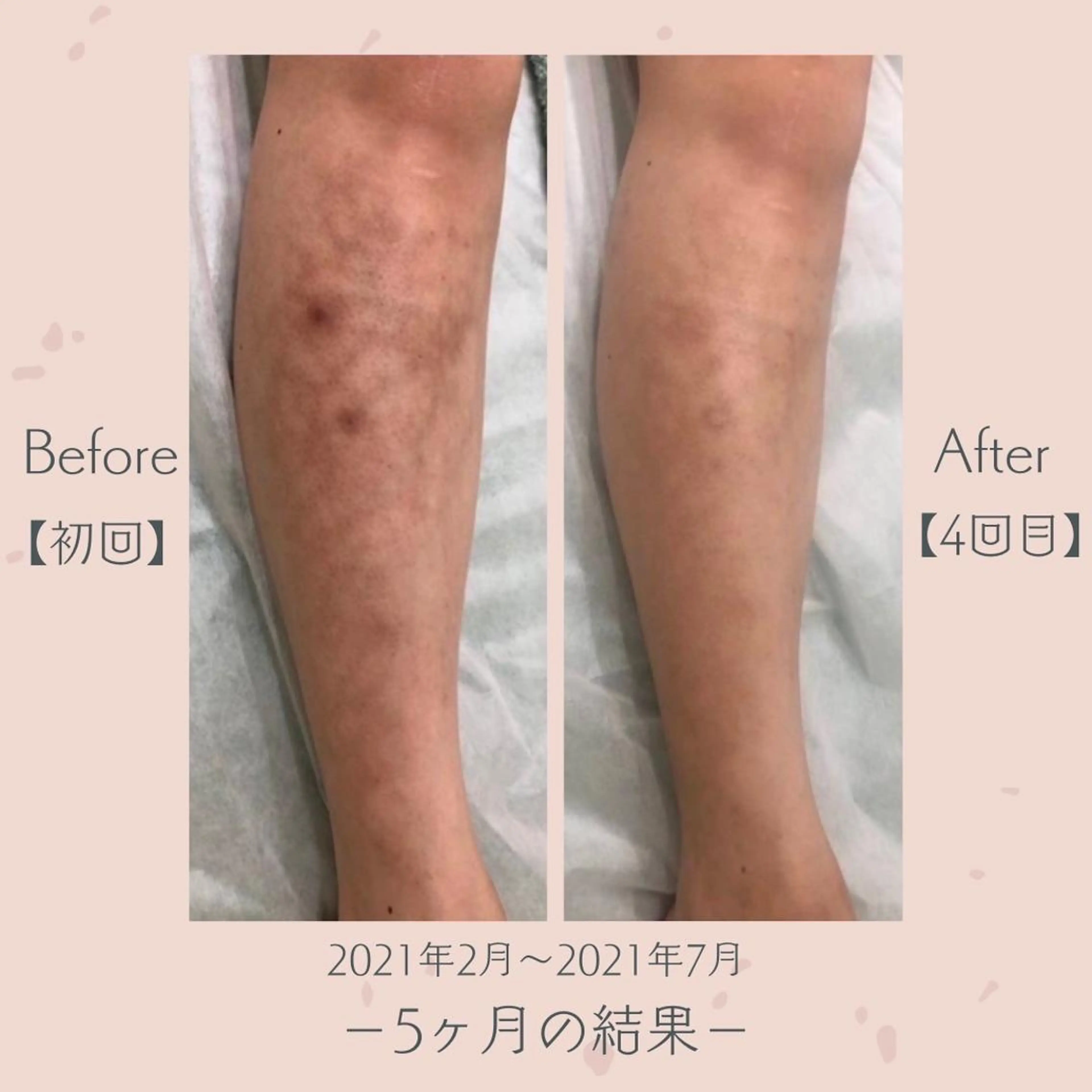 エステ＆美肌脱毛 ココサロ倉敷店のエステ・リラクイメージ