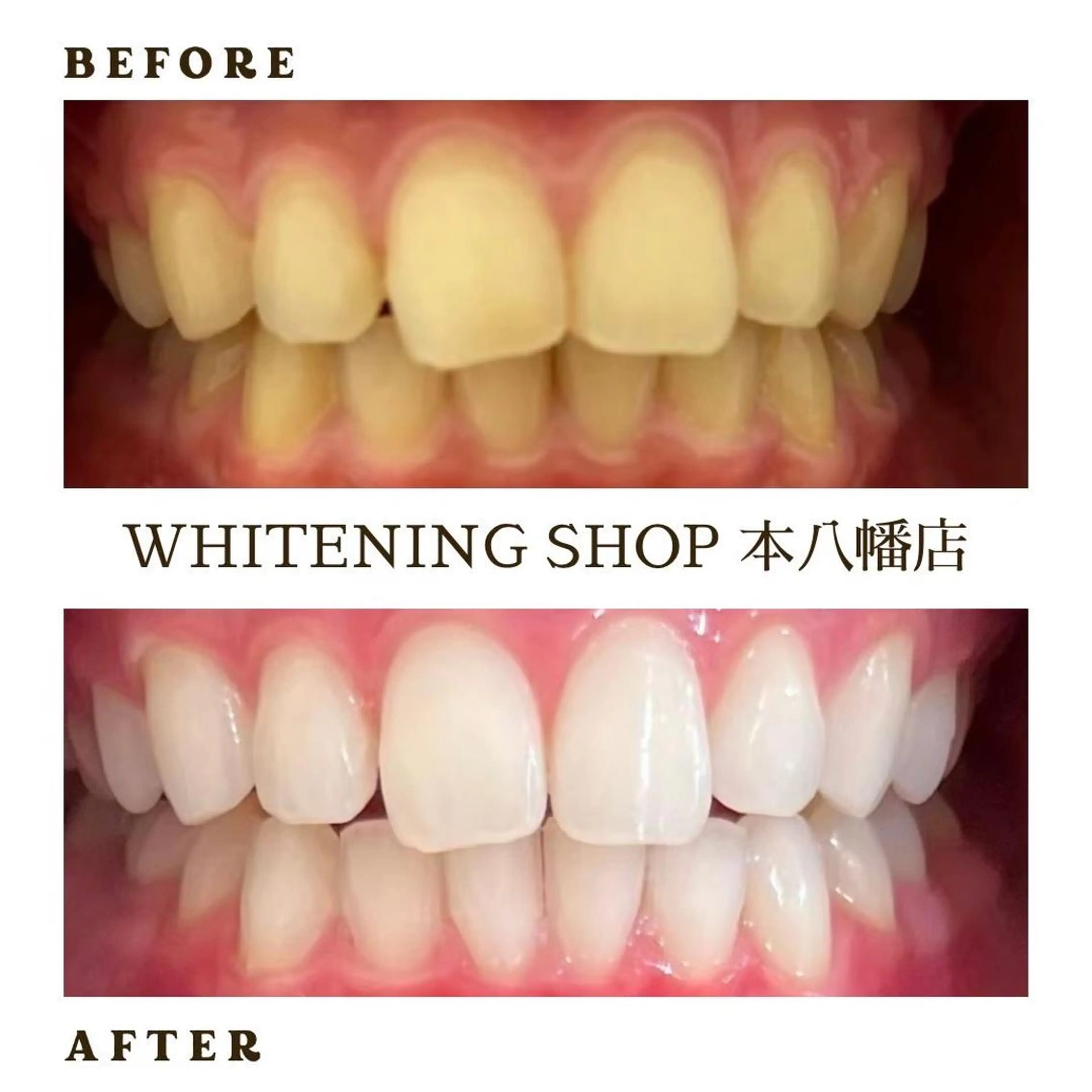 メンズ エステ リラク ホワイトニング ショップ本八幡店のエステ・リラクイメージ