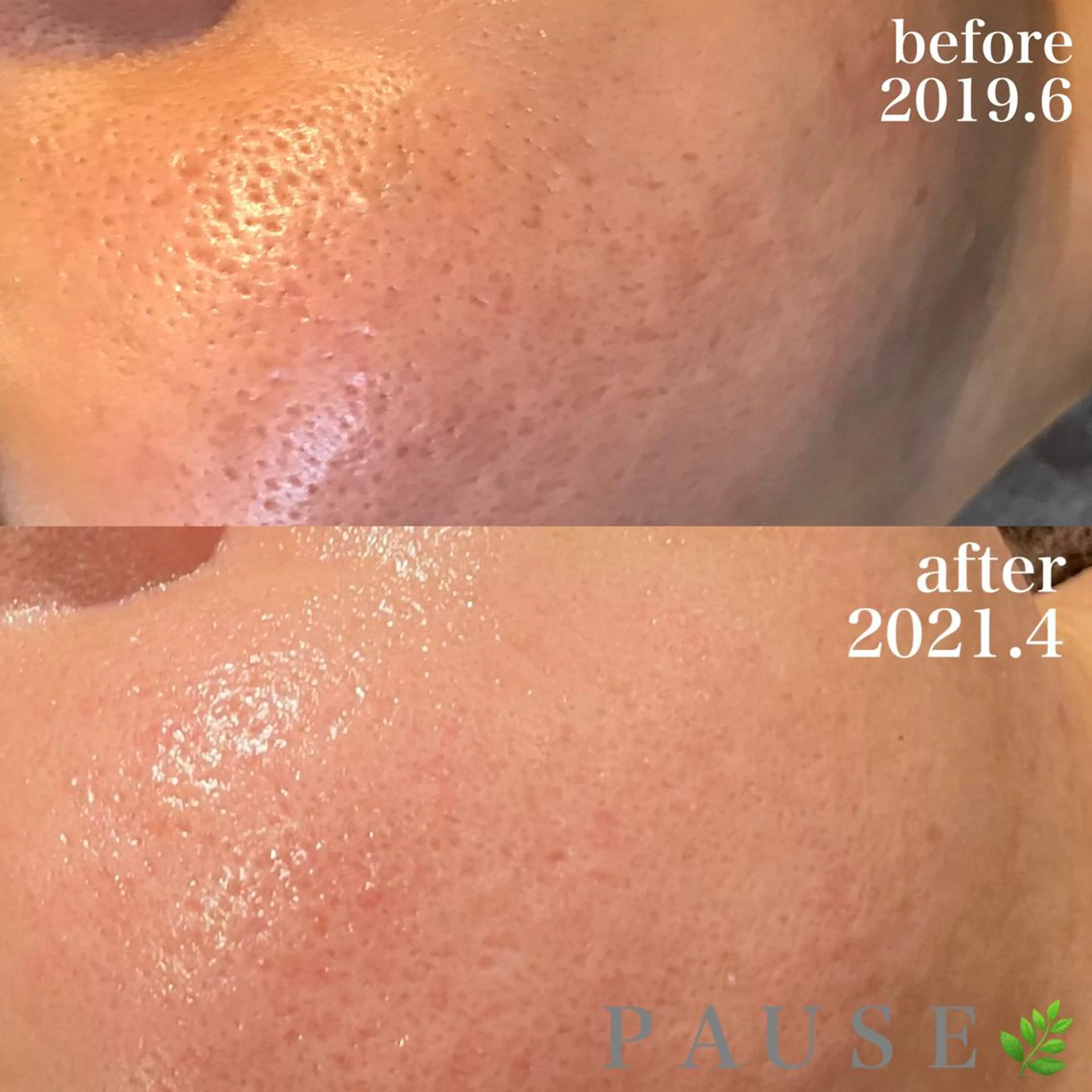 エステ 浜野 恵美のエステ・リラクイメージ