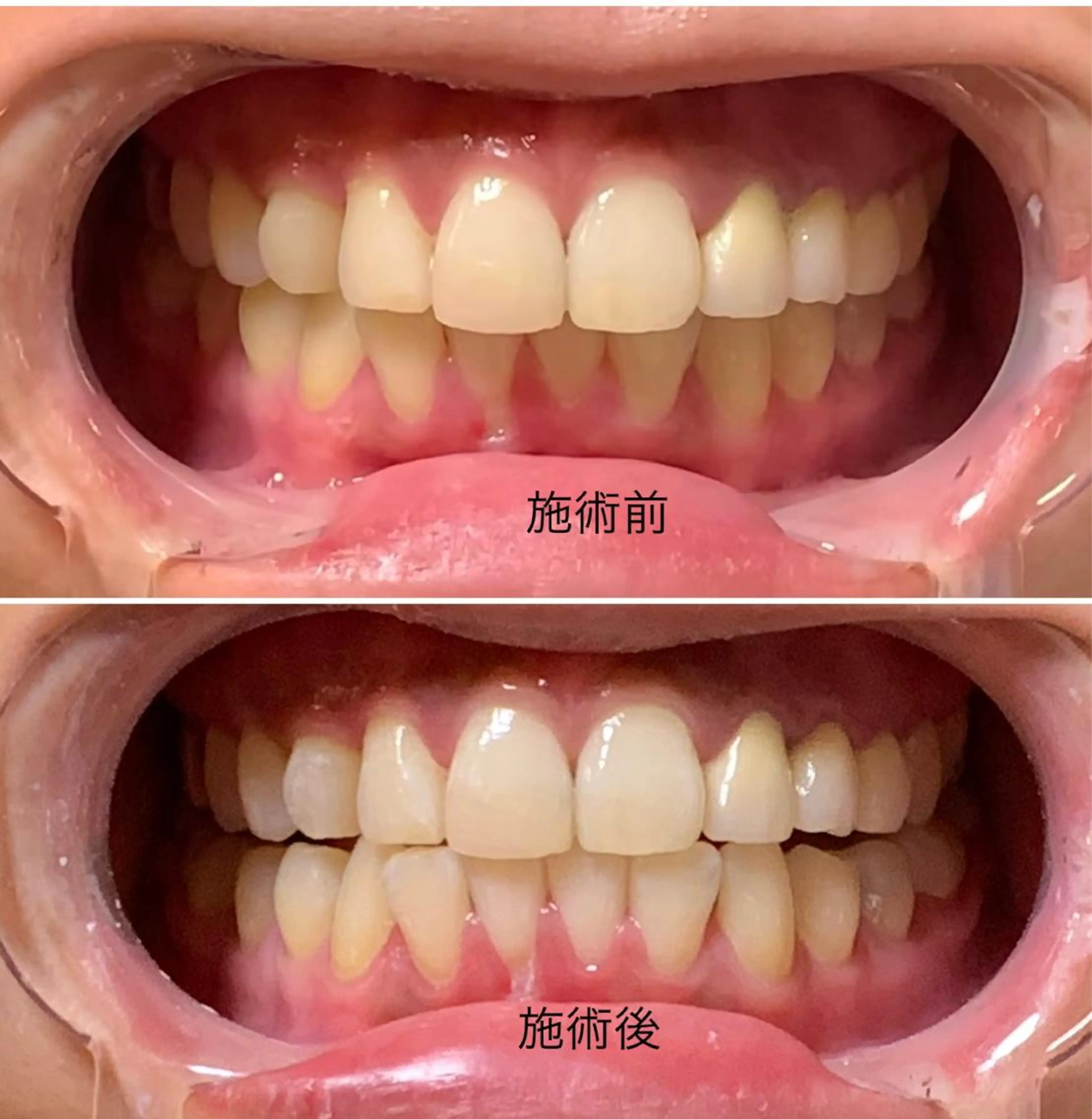 整体フェイシャル EMINALのエステ・リラクイメージ