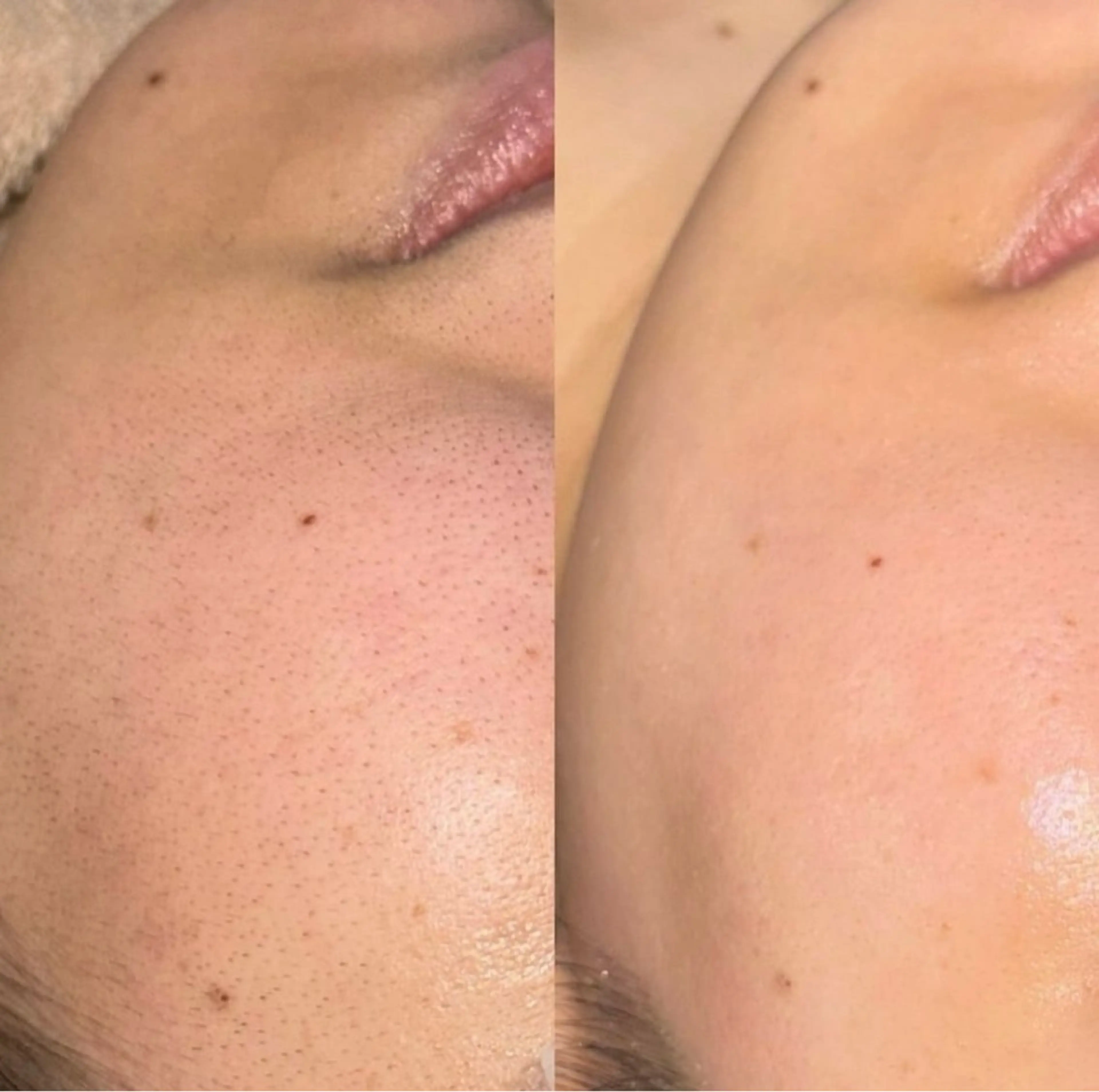 肌が綺麗になるフェイスwax ハイドロジェリーマスク付きの写真