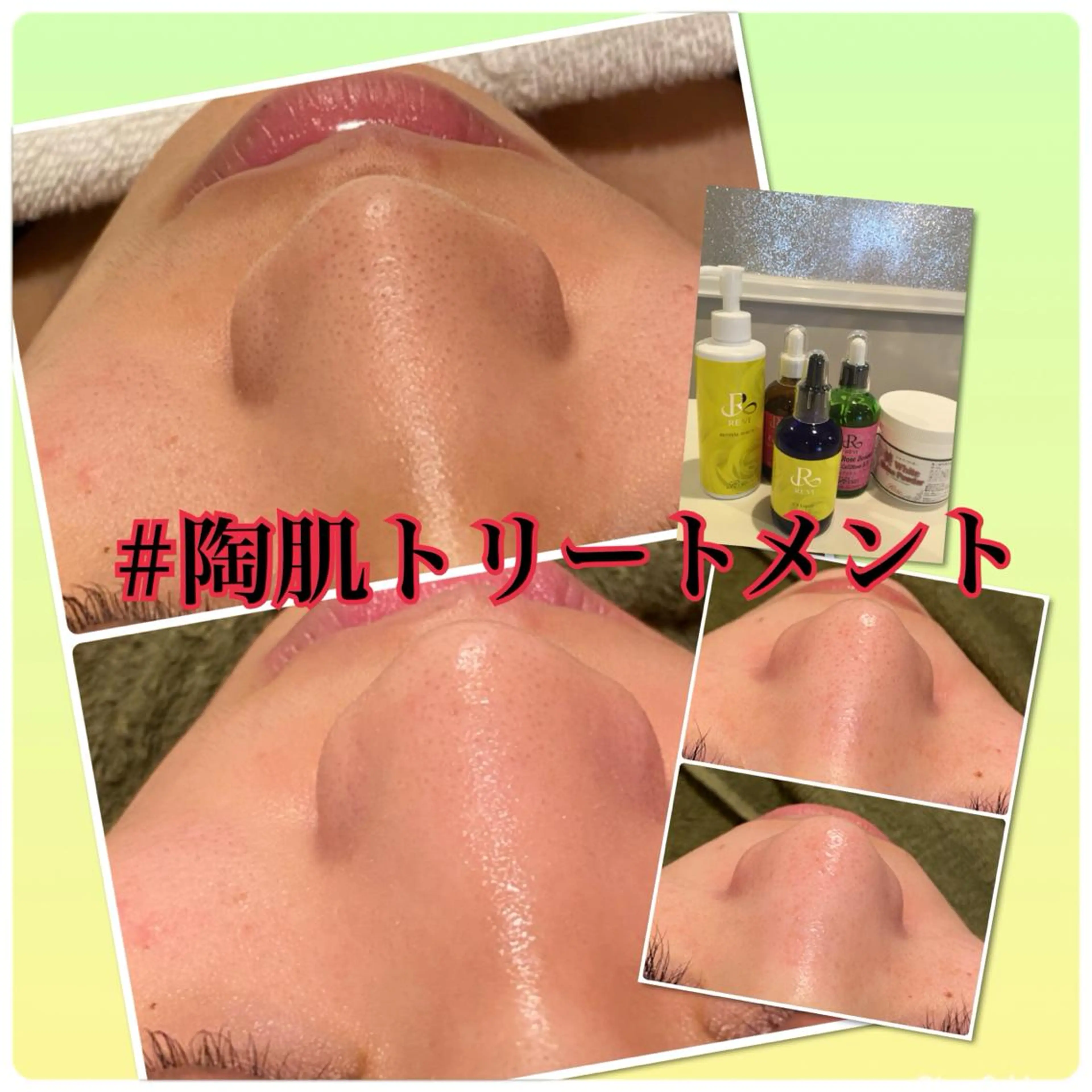 エステ 【リベルハーブピーリング認定店】敏感肌・美白脱毛専門店Dione立川店所属・Dione 立川店のエステ・リラクイメージ