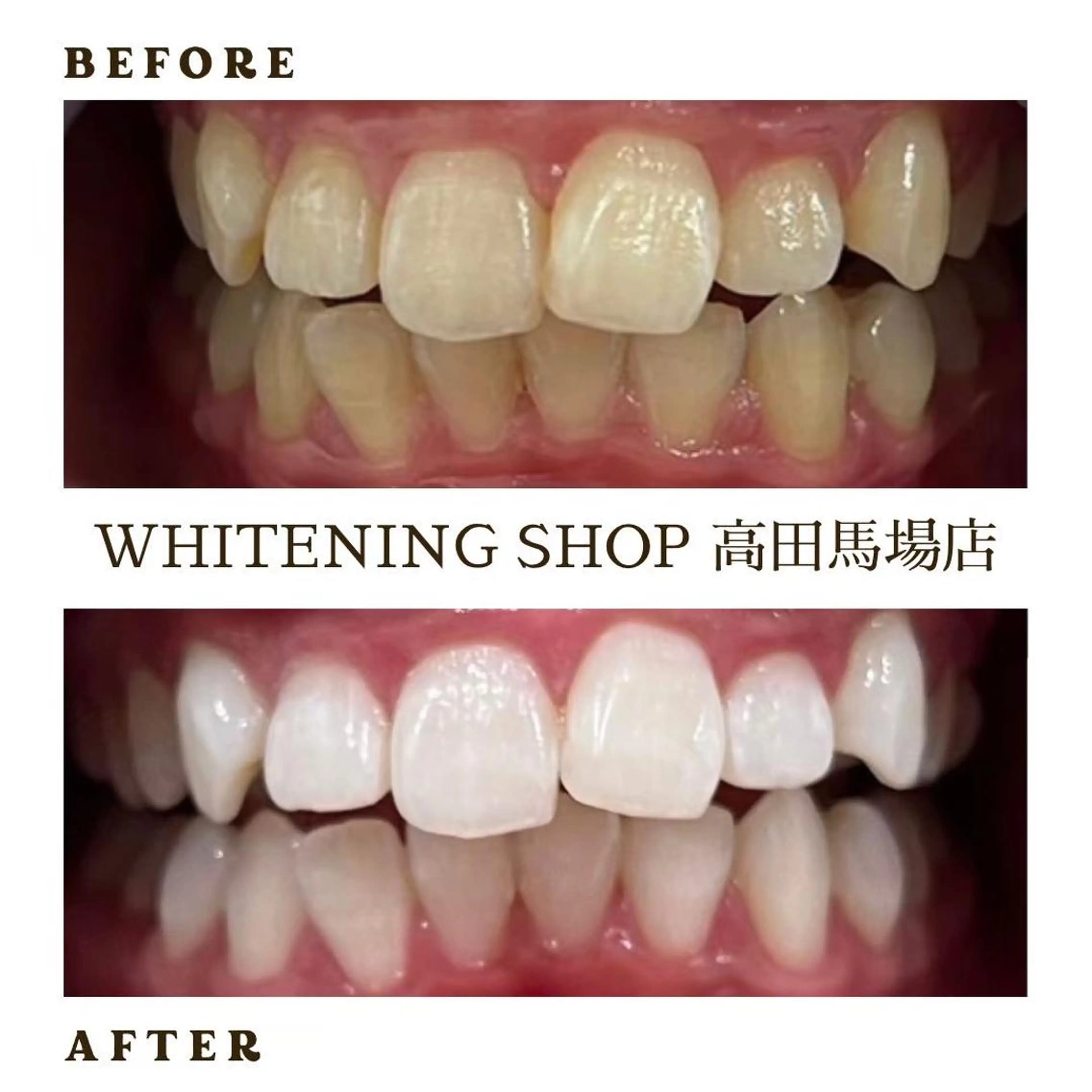 メンズ その他 ホワイトニング ショップ高田馬場店のその他イメージ
