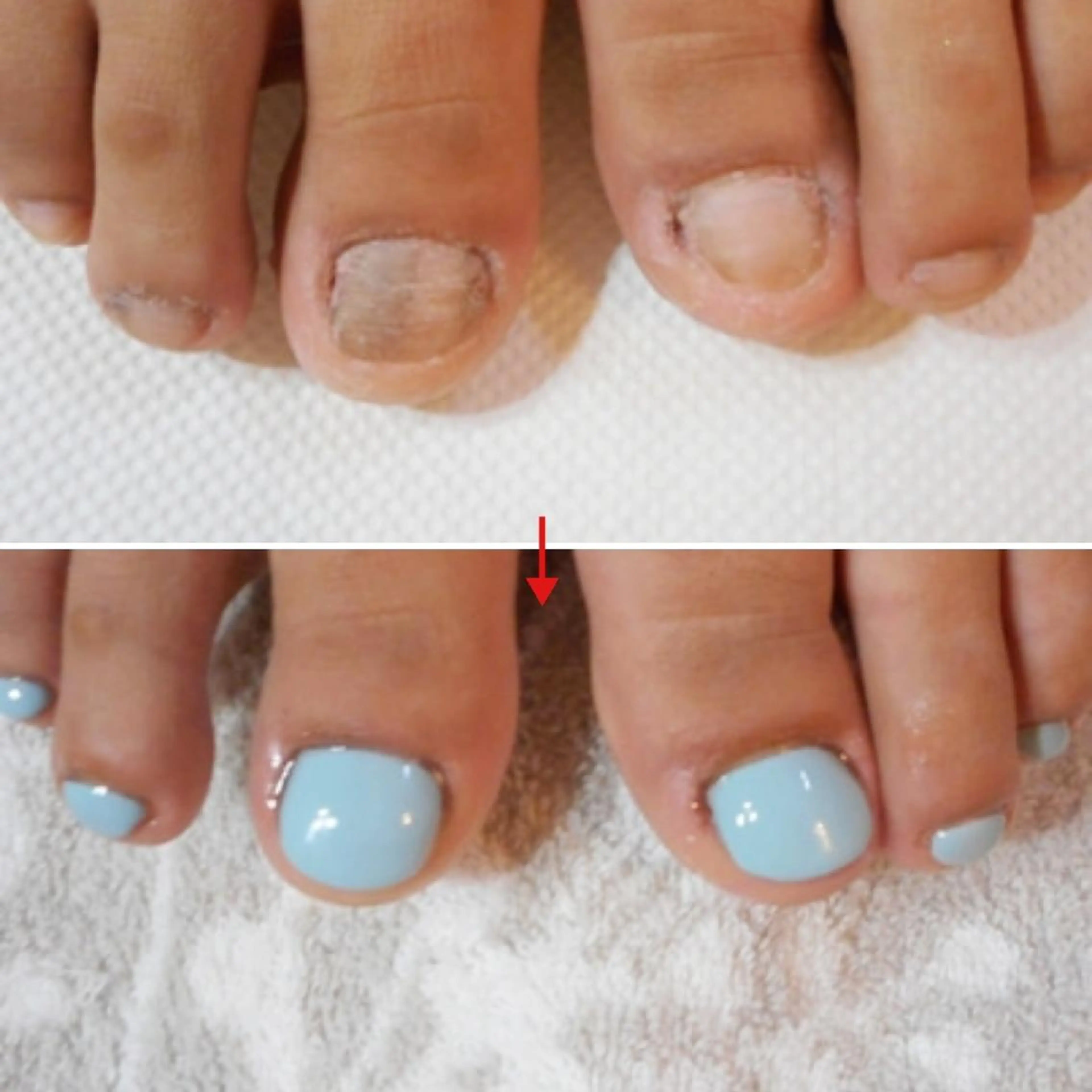 ネイル フットネイル ネイルサロンアリューム所属・ネイルサロン アリュームのネイルデザイン