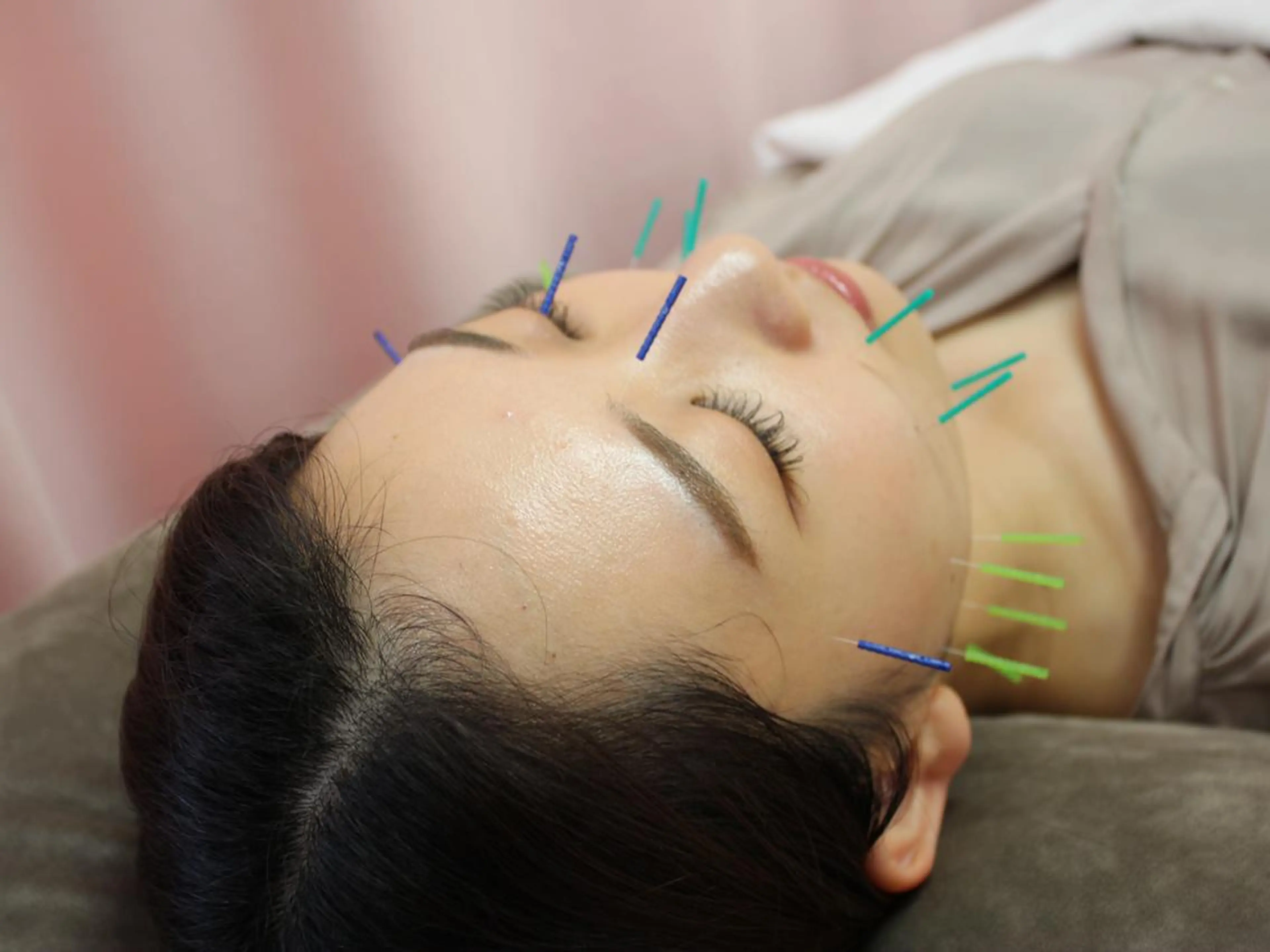 エステ リラク 同心整骨院 美容鍼・整体・小顔のエステ・リラクイメージ